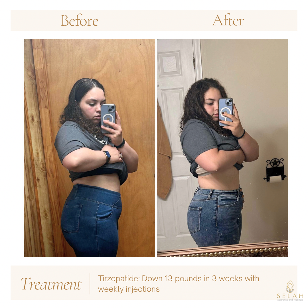A before and after photo of a woman taking a selfie in front of a mirror.