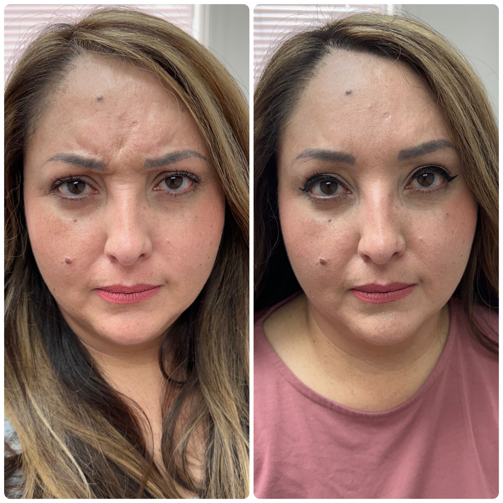 A before and after photo of a woman 's face.
