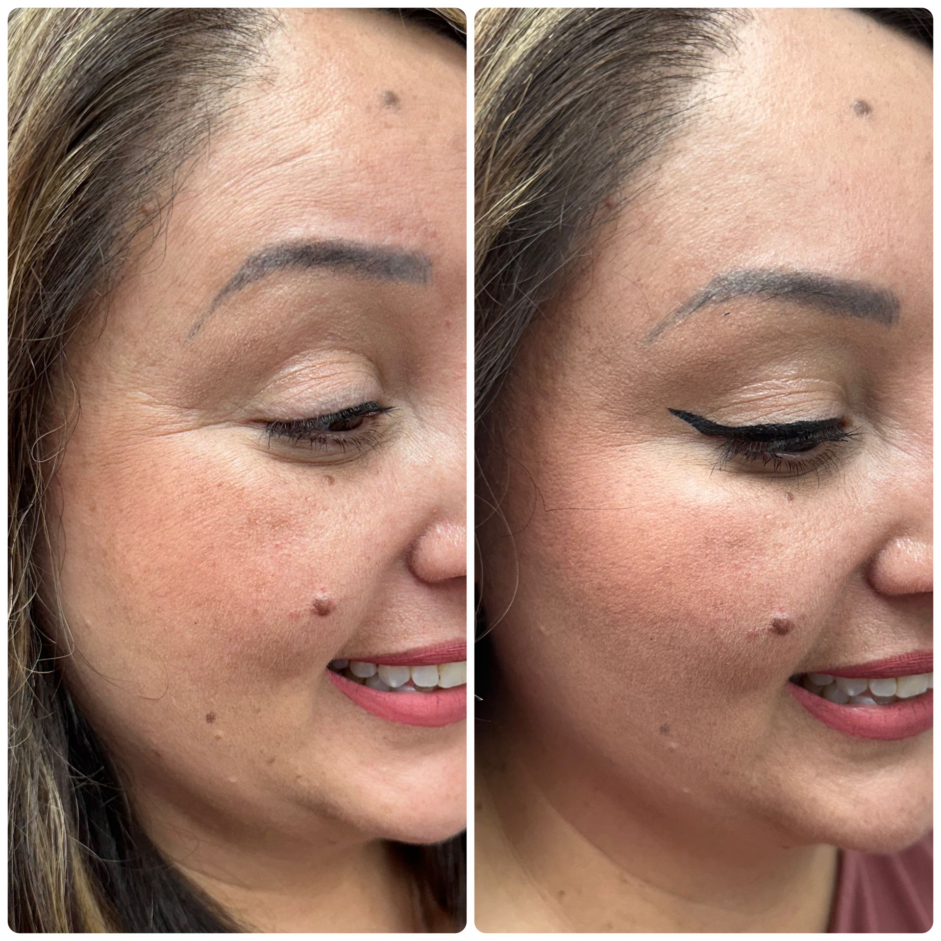 A before and after photo of a woman 's face.