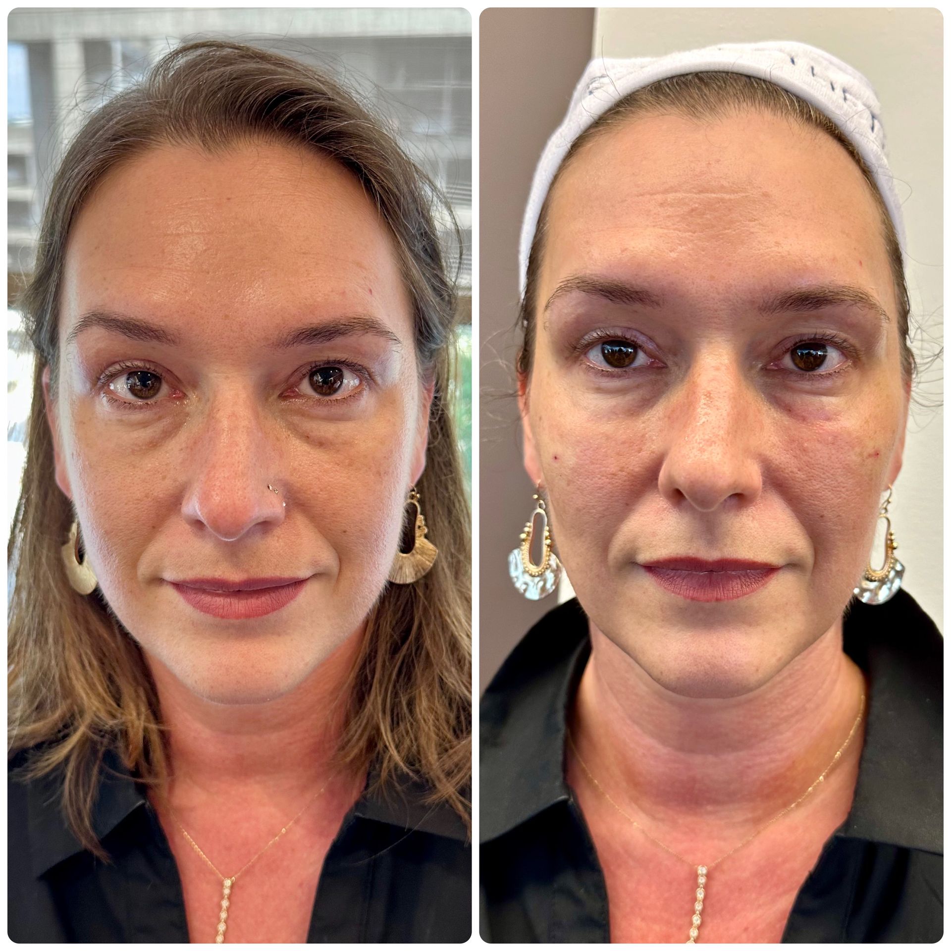 A before and after photo of a woman 's face with and without makeup.