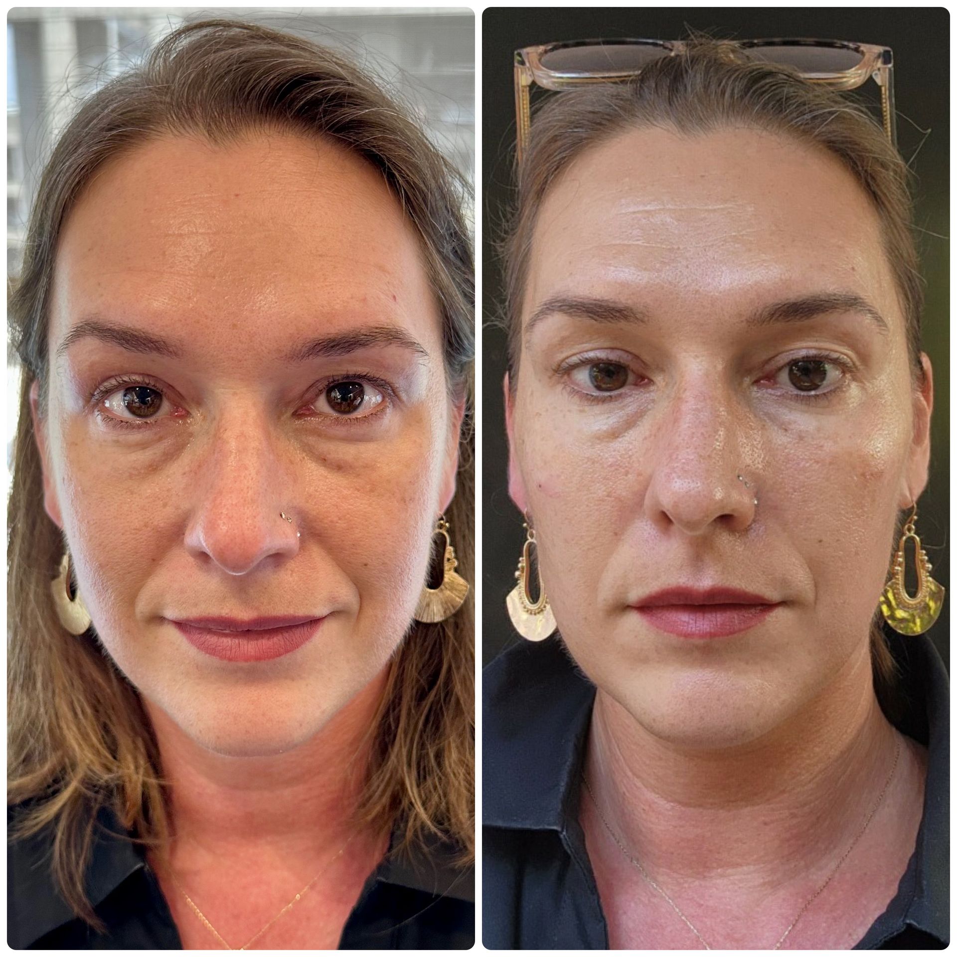 A before and after photo of a woman 's face with and without makeup.