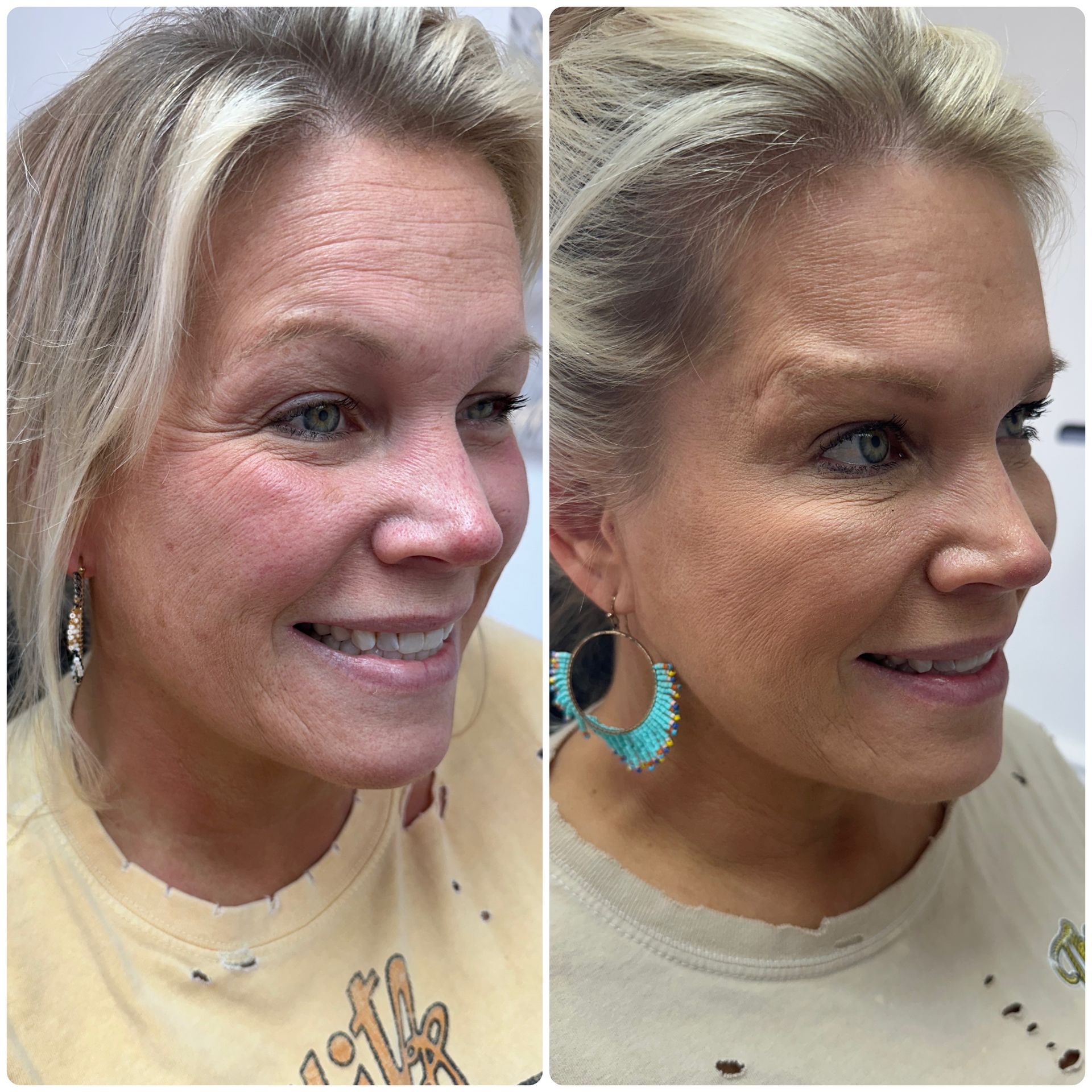 A before and after photo of a woman 's face.