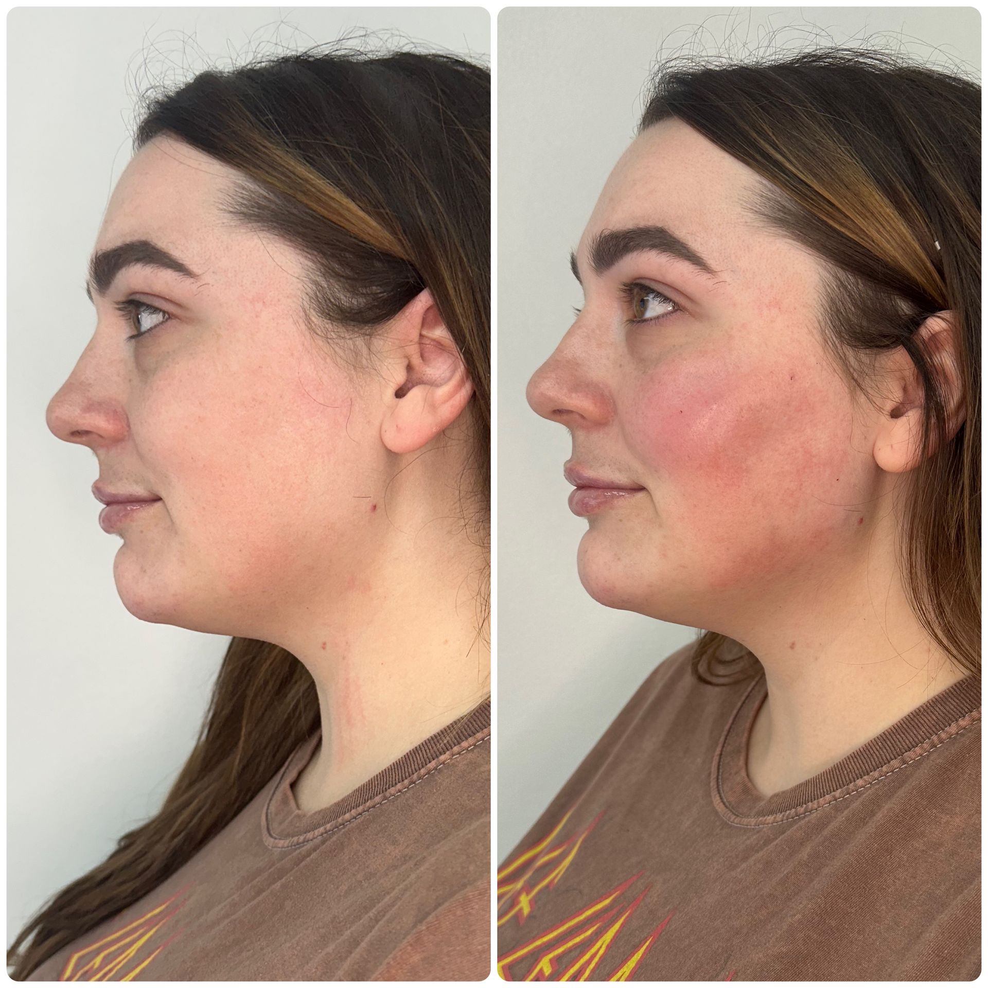 A before and after photo of a woman 's face.