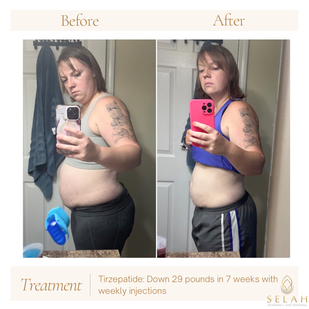 A before and after picture of a woman taking a selfie in front of a mirror.