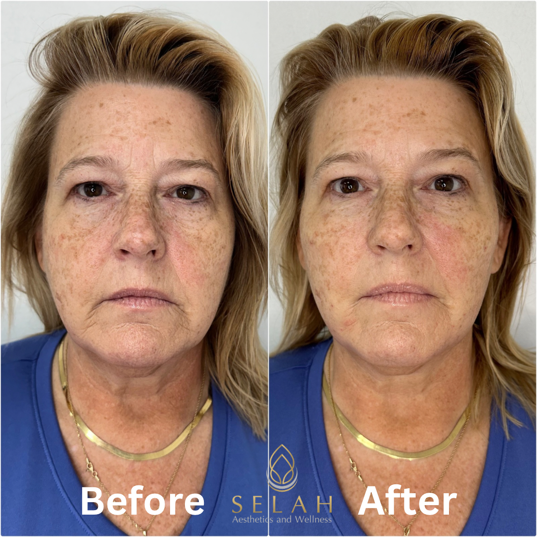 A before and after photo of a woman 's face.