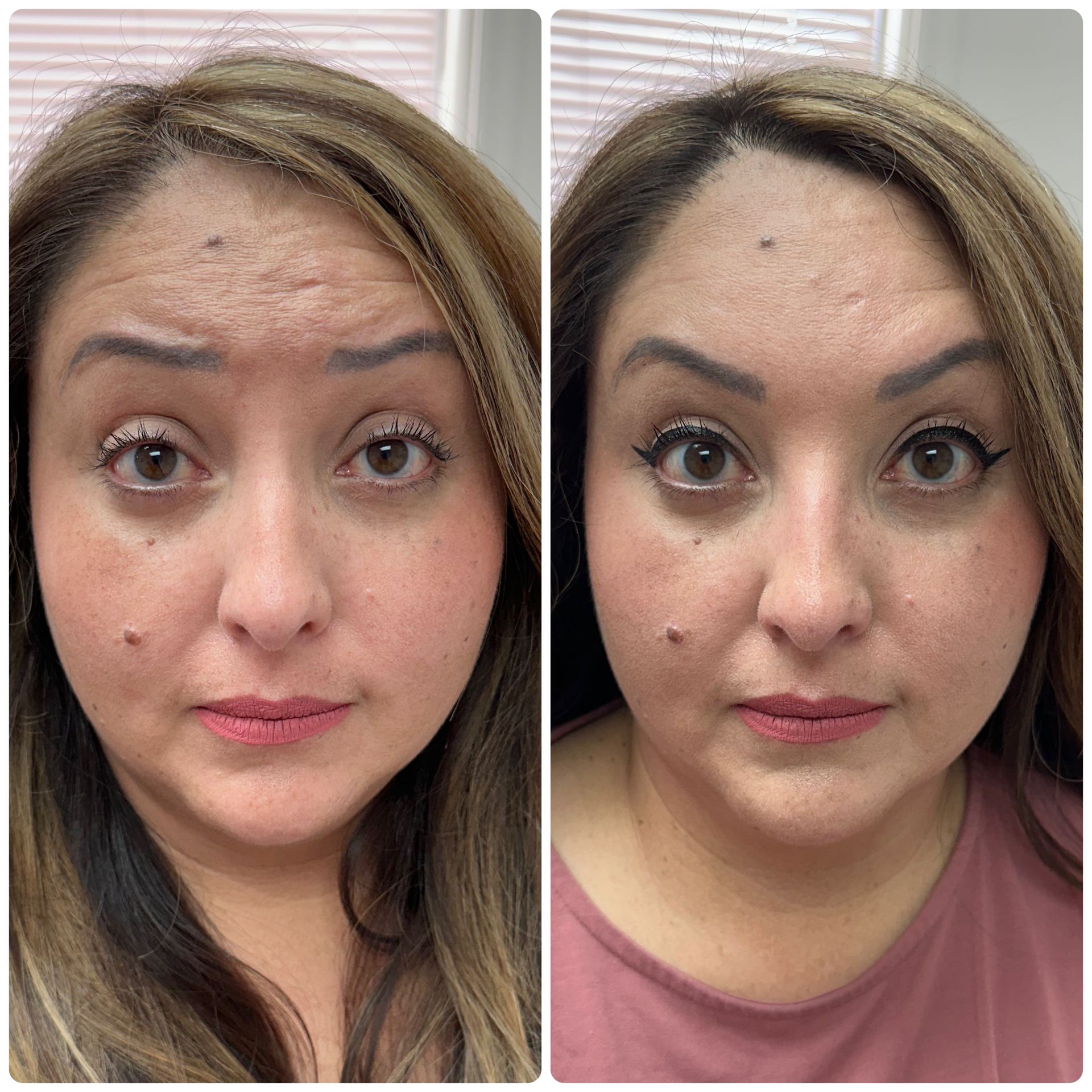 A before and after photo of a woman 's face.
