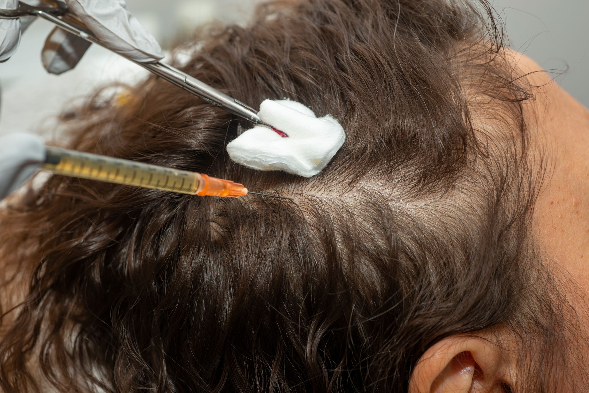A woman is getting an injection in her hair.