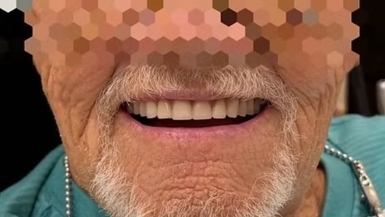 Close-up of a smiling mouth with teeth, showing a gray mustache and beard.
