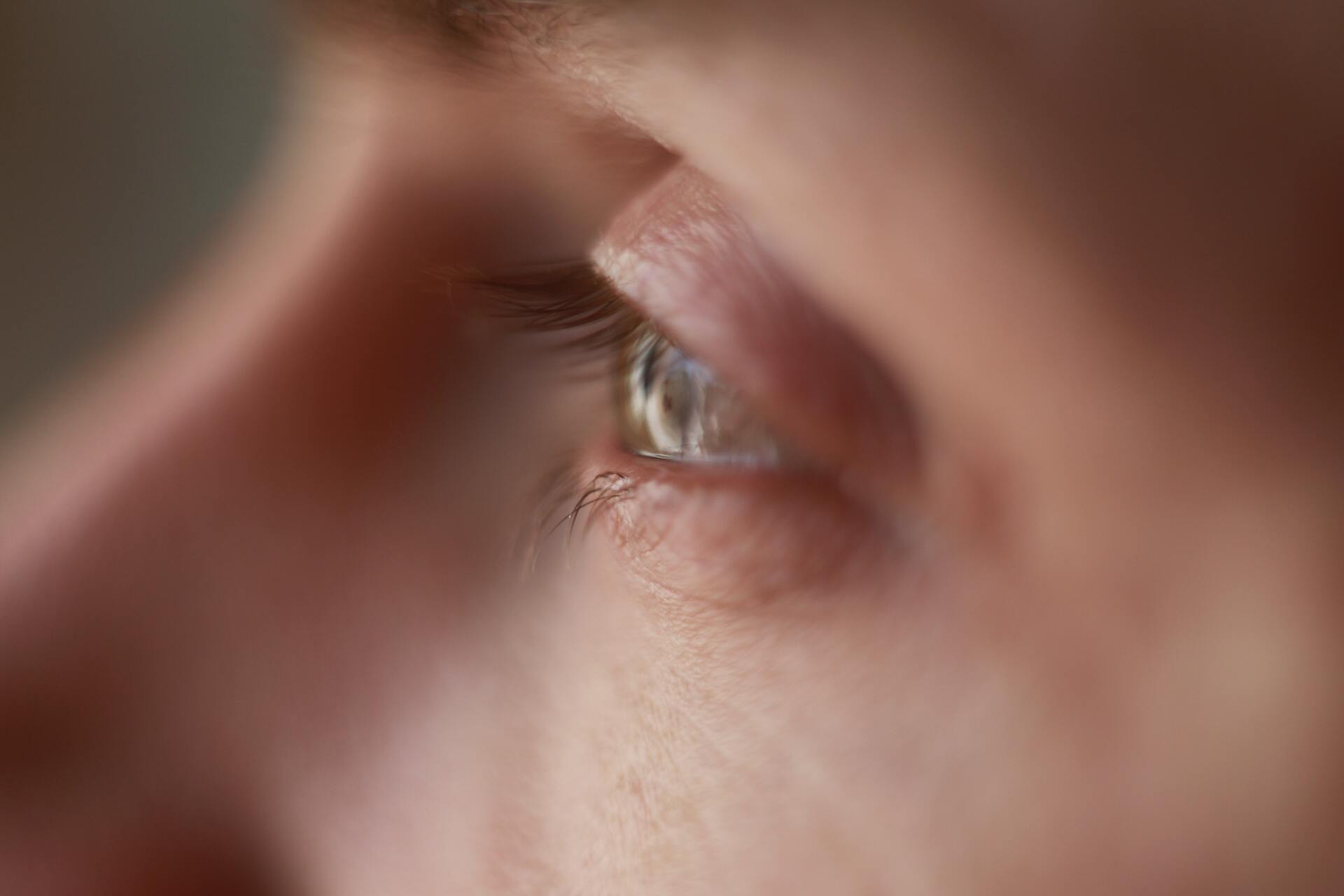 A man having a tear duct blockage problem.