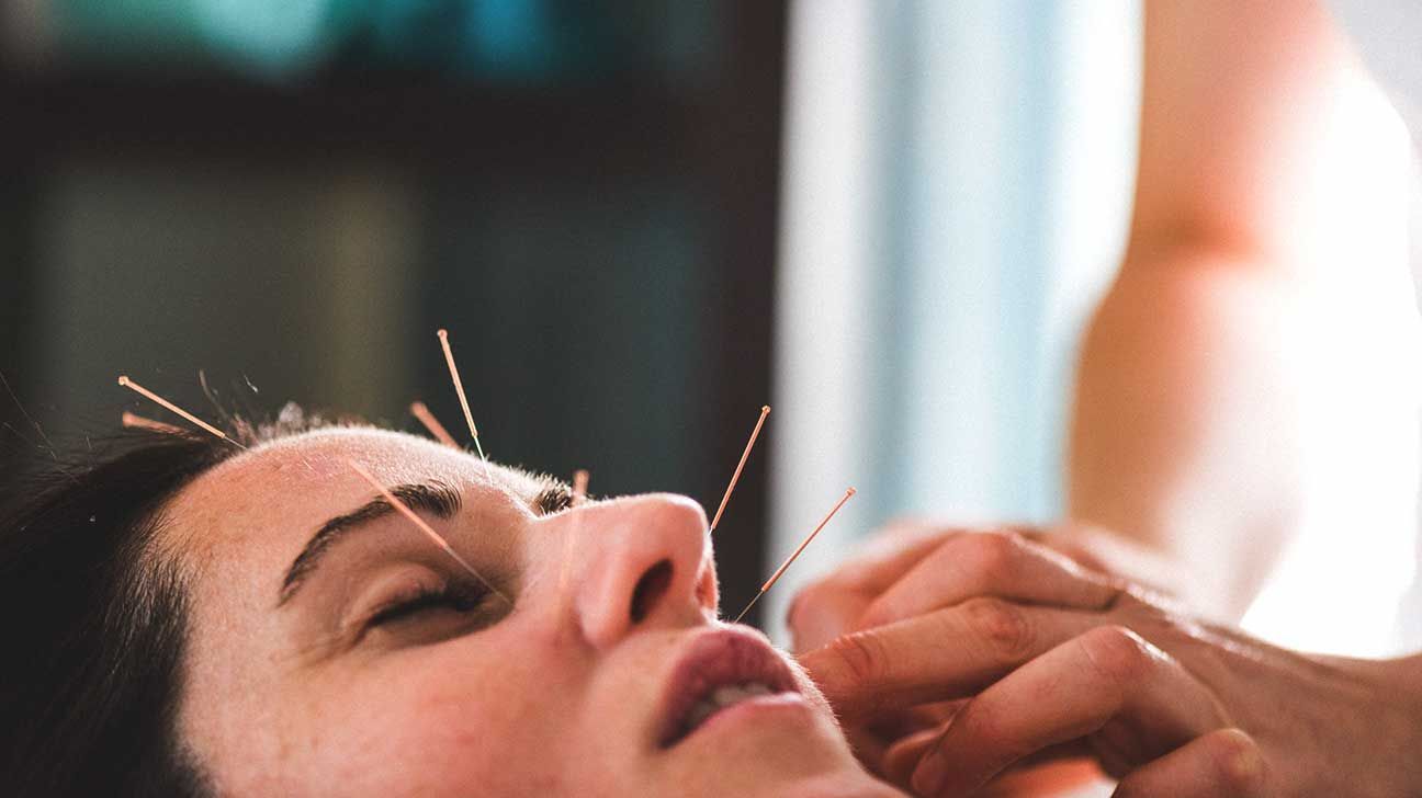 A woman is getting acupuncture on her face.