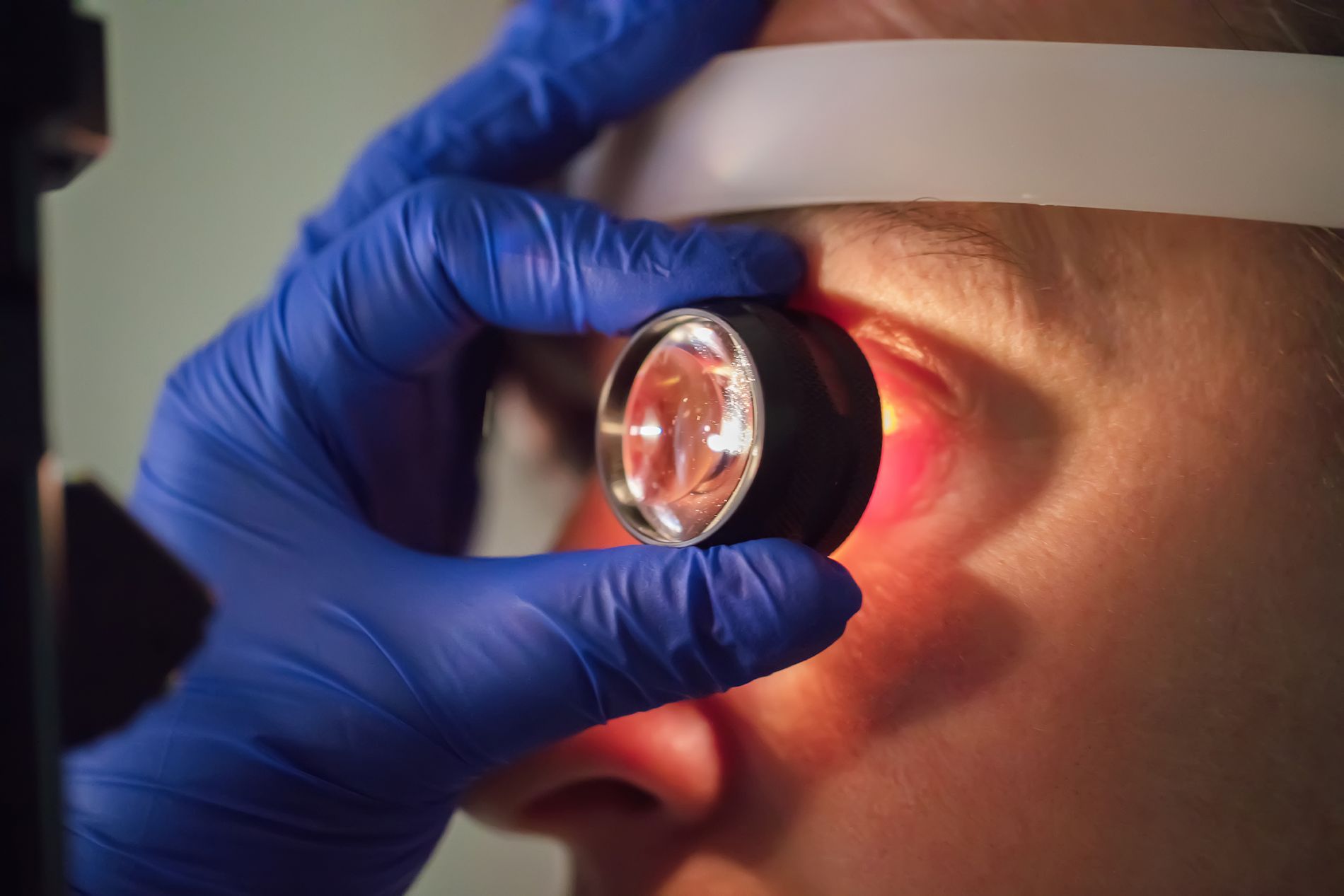 Diagnosi ottica