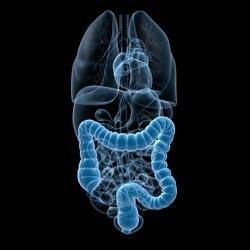 DR. LUIS FERNANDO LEAL HERNANDEZ - Cáncer de colon