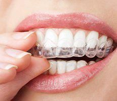 Invisalign