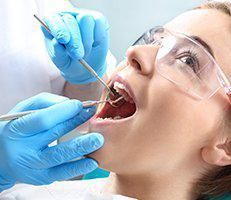 Root Canals