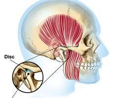 TMJ Treatment
