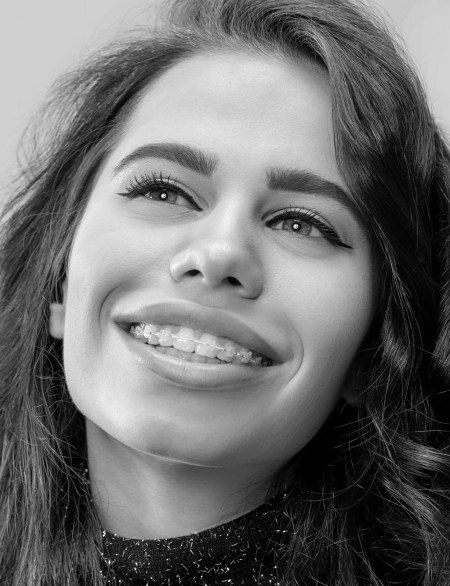 B&W close-up of a smiling young woman with clear ceramic braces.