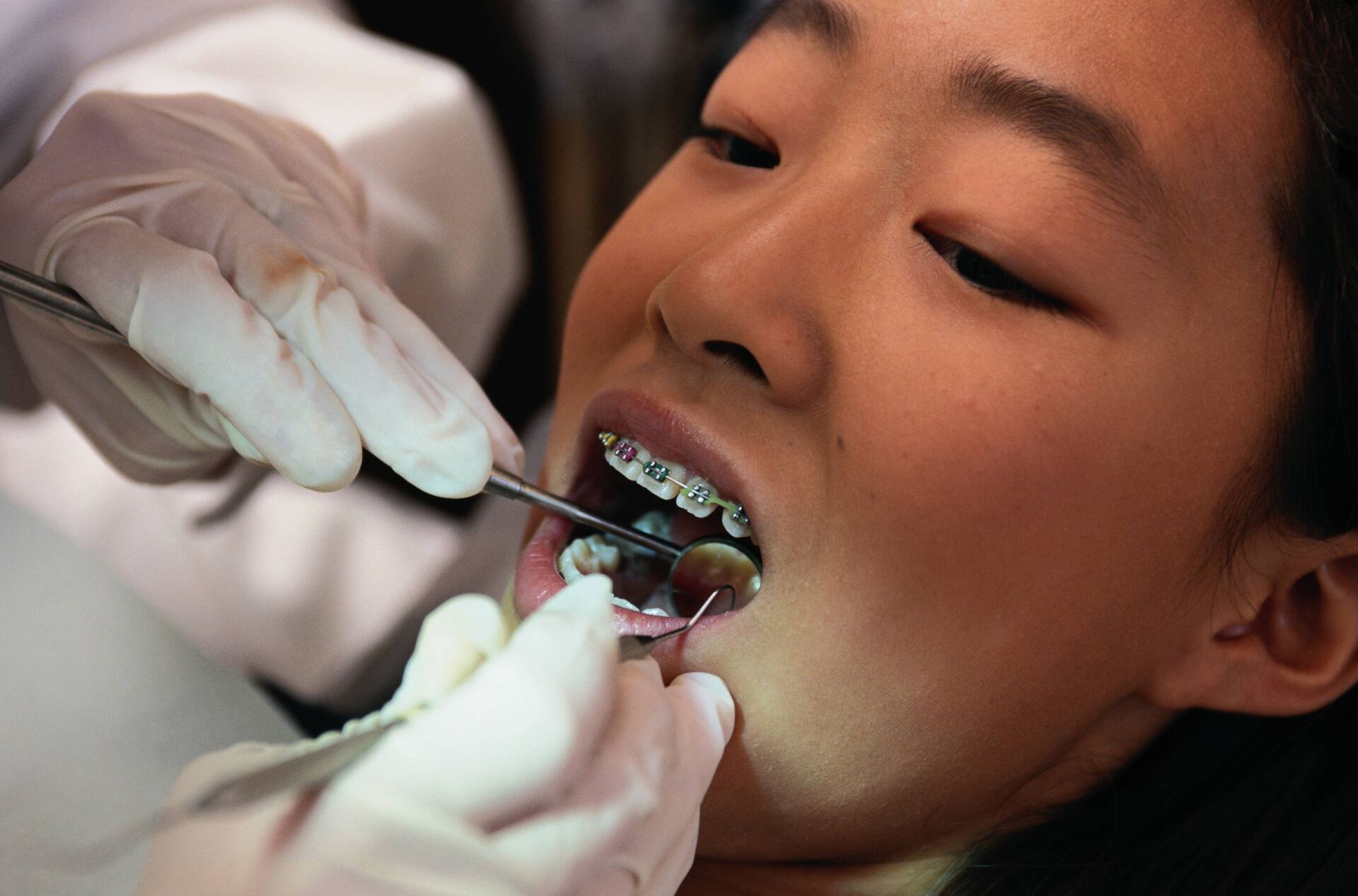 Girl at the orthodontist — Colorado Springs, Co — West One Family Dental