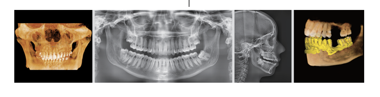 X-Rays