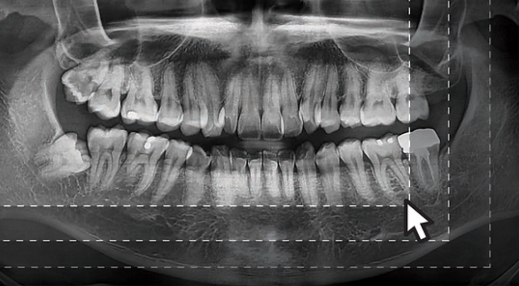 X-Rays