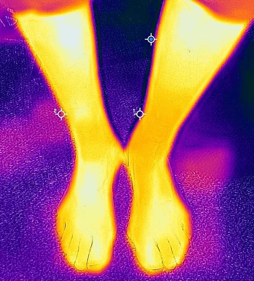 A person 's feet are glowing in a thermal image.