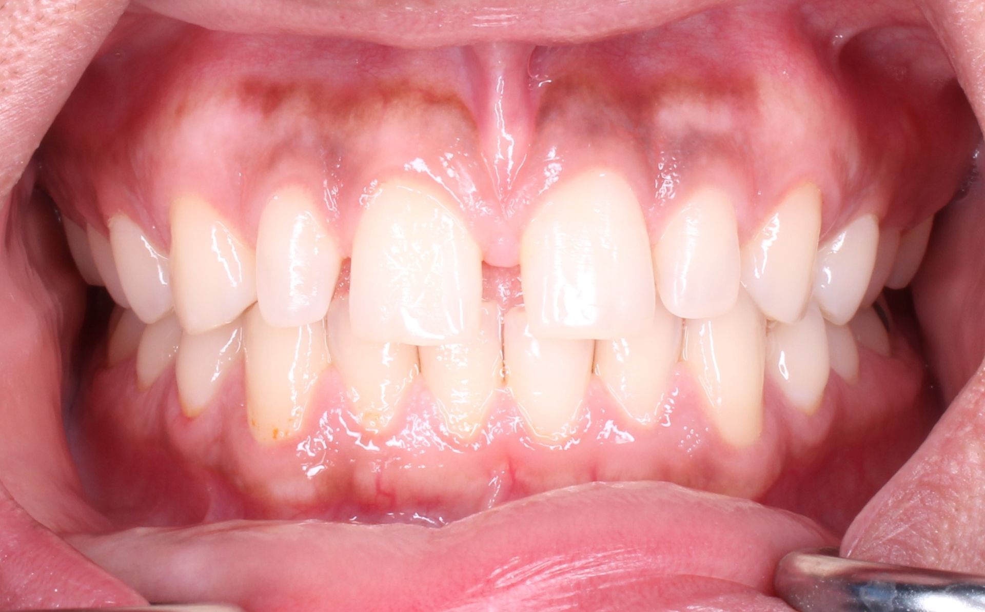cosmetic dentistry image of teeth