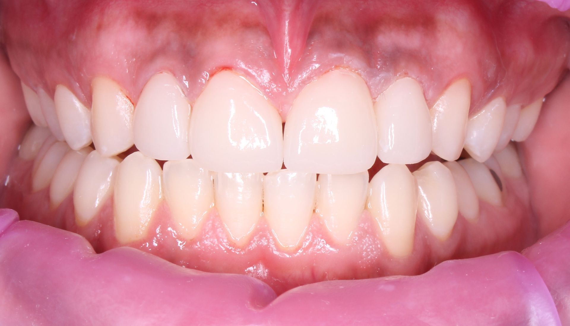 cosmetic dentistry image of teeth