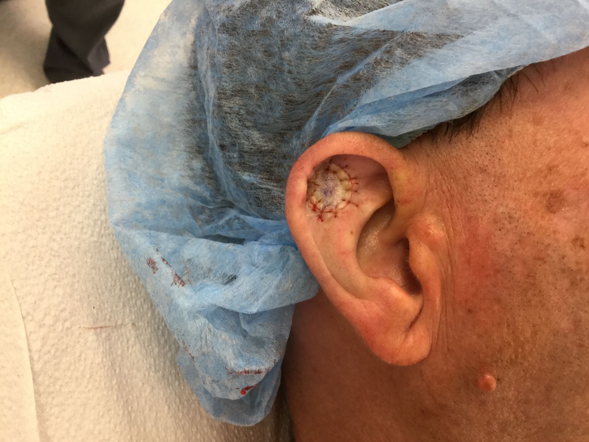 A close up of a person 's ear wearing a surgical cap.