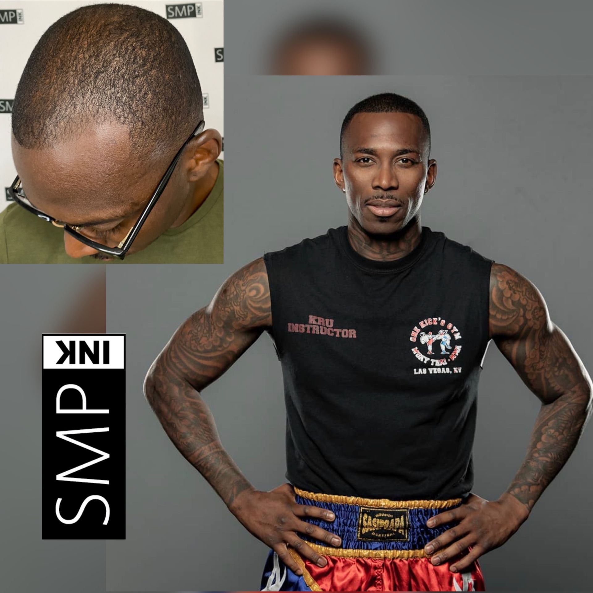 Before-and-after headshot of a man with shaved hair loss; full-body portrait beside it, with 