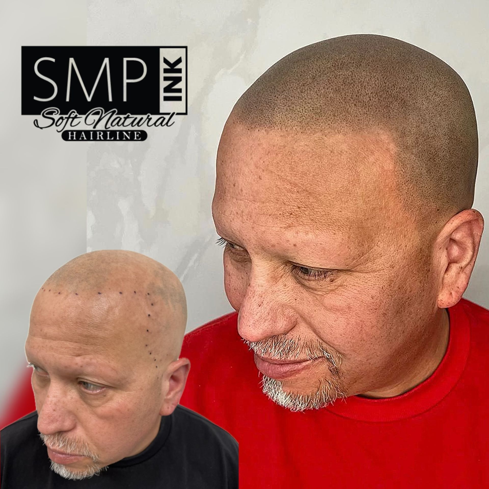 Before and after scalp micropigmentation on a man, with black logo text in the upper left.