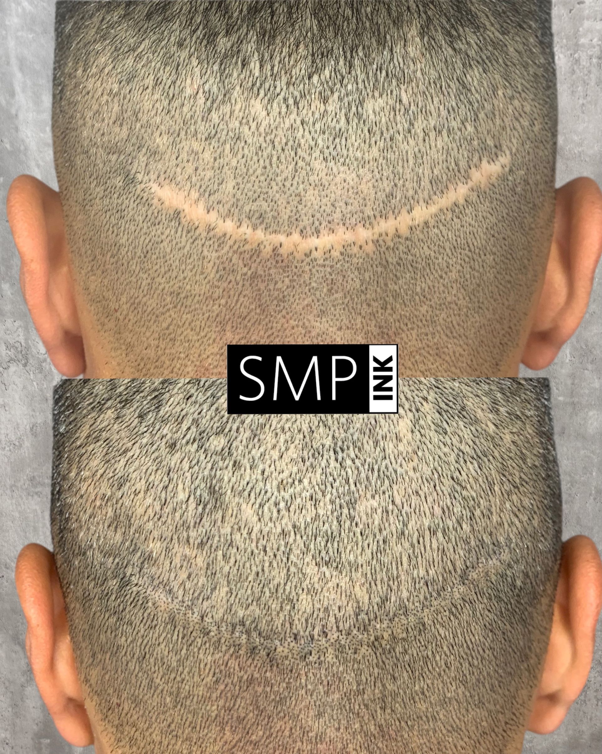 SMP Inc CDA before and after