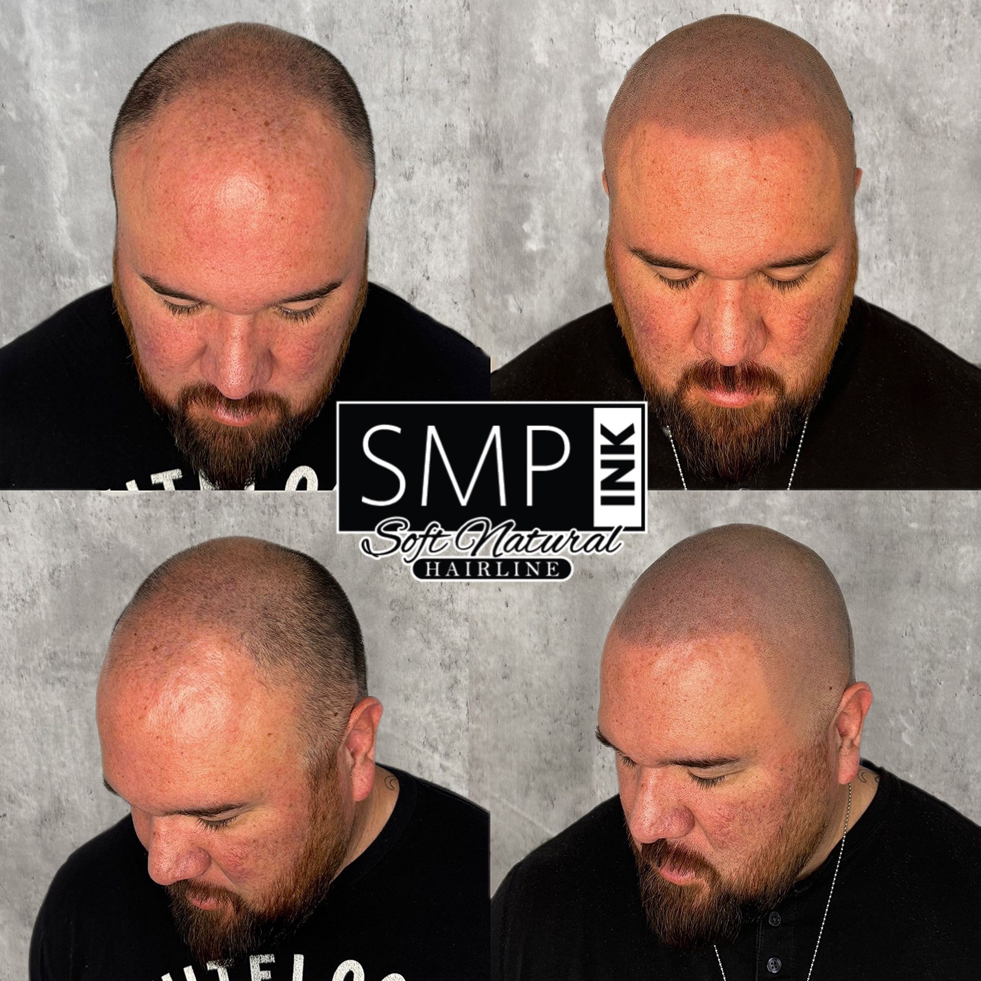 Four-panel collage of a bald man with a beard, showing different angles of his head and face on a gray background.