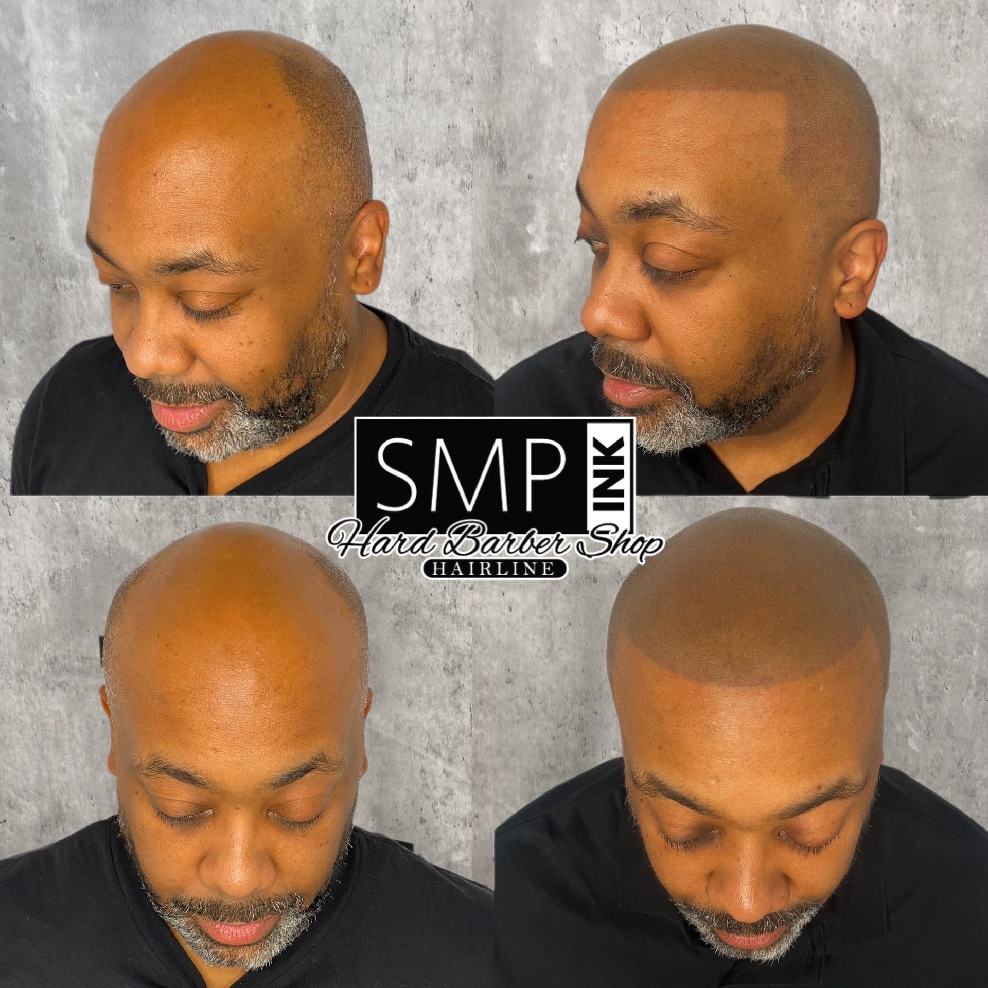 Four views of a shaved head and beard haircut, shown from angles against a gray background.