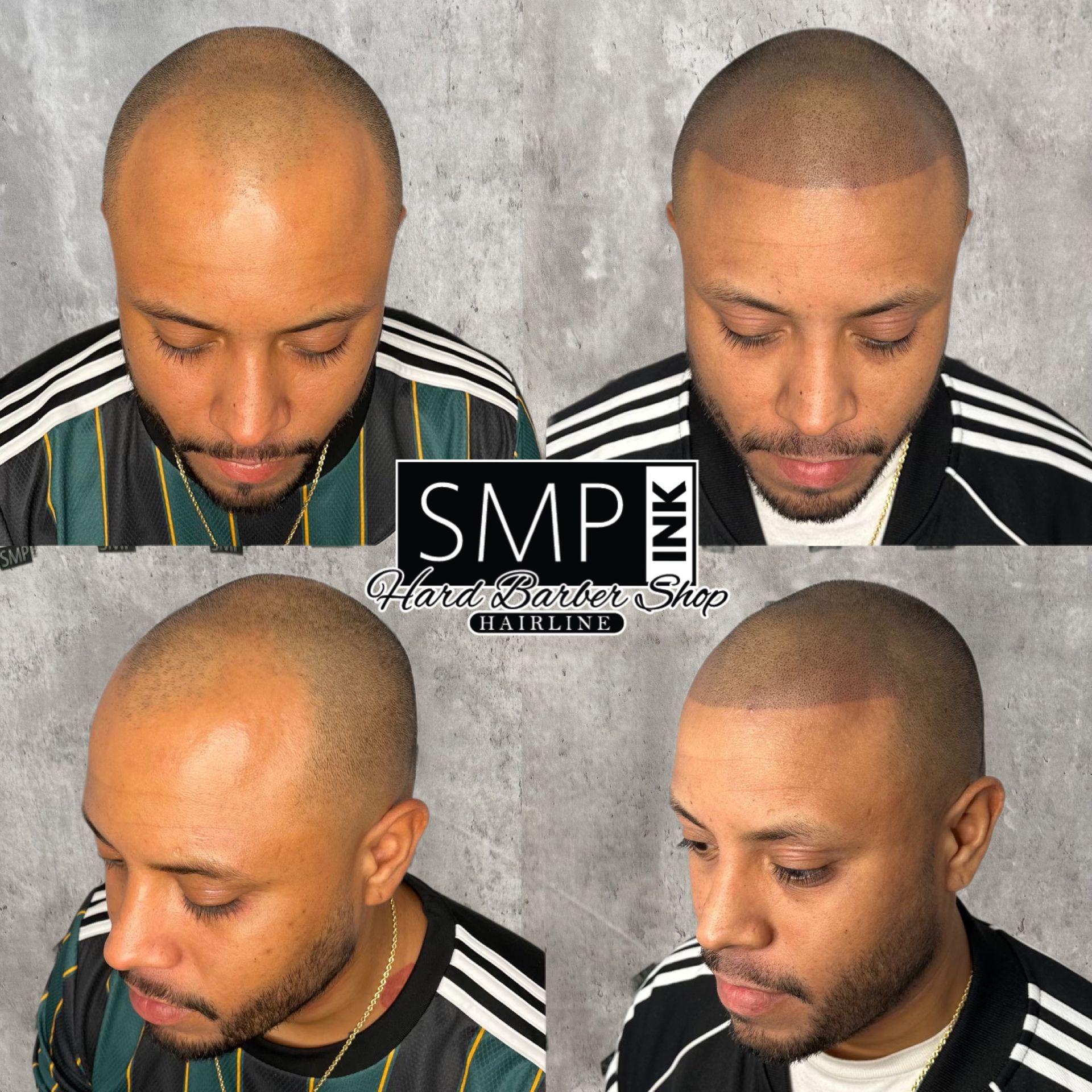 Four views of a man with scalp micropigmentation on a gray backdrop, showing a shaved head and beard.