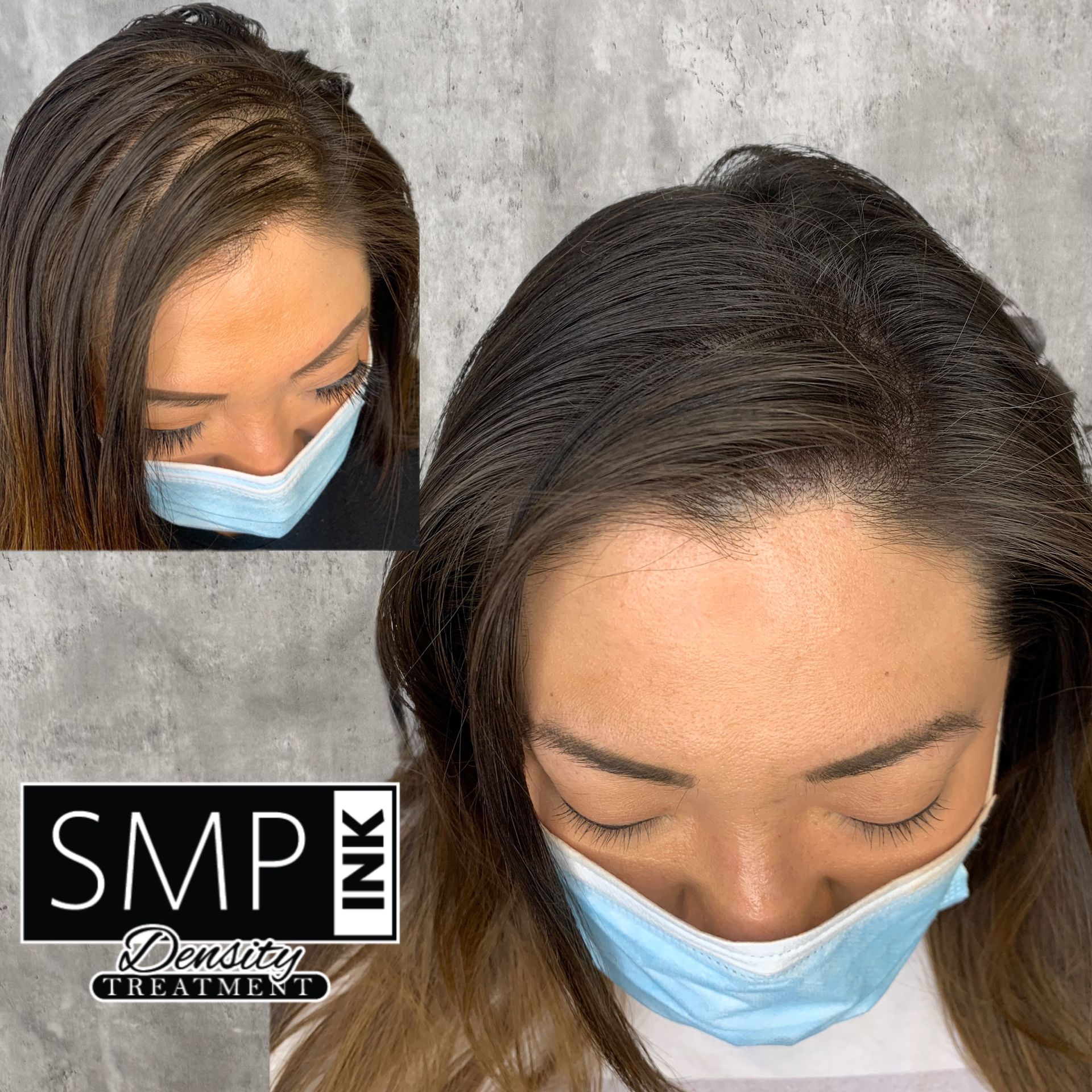 Close-up of scalp micropigmentation results on dark hair, with before-and-after views and SMP INK logo