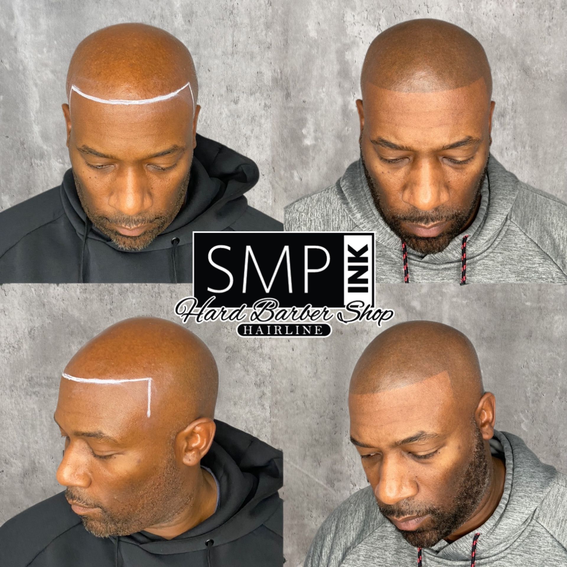 Four-panel before-and-after of a shaved head with scalp micropigmentation treatment results.