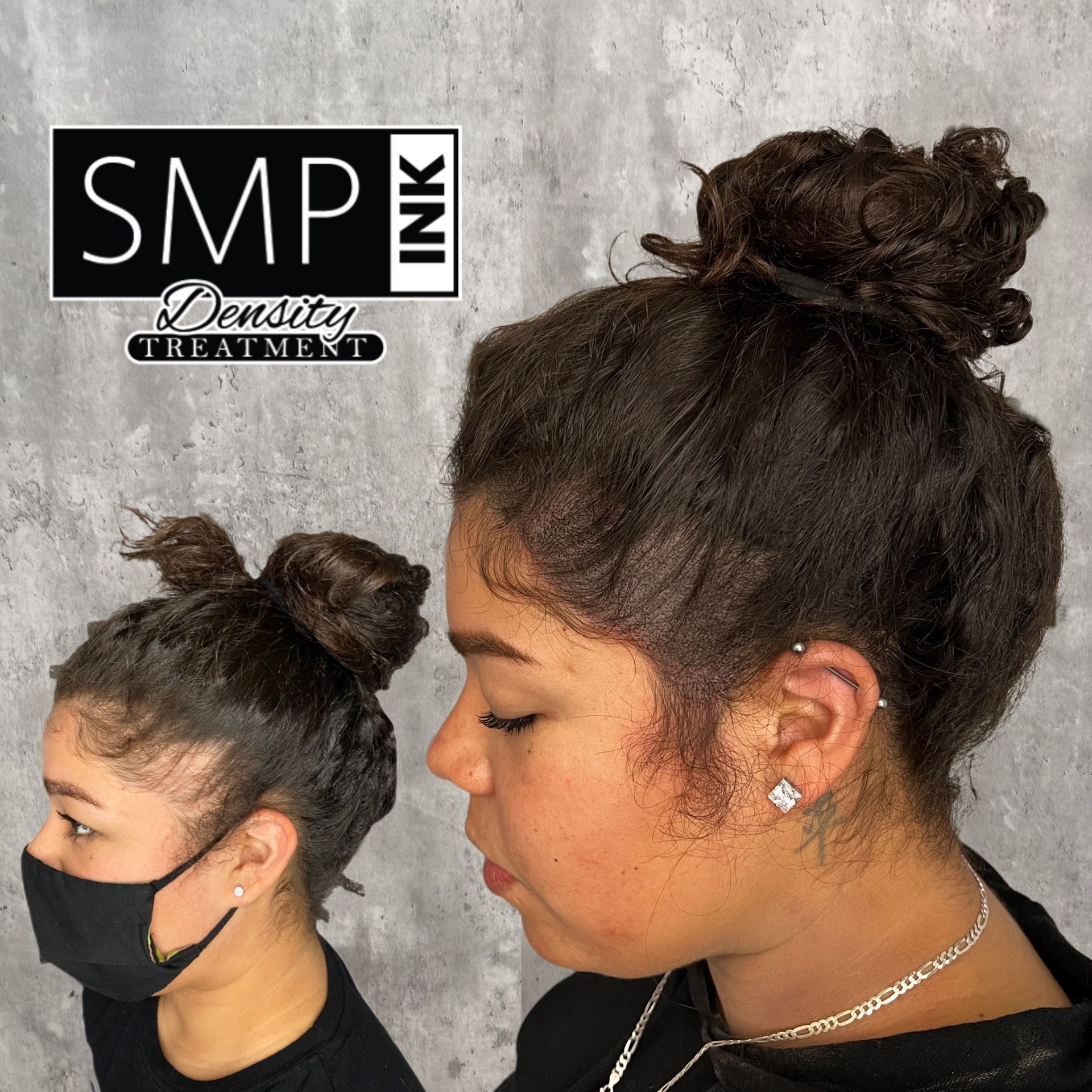 Woman with dark hair in a bun showing SMP Ink density treatment logo and before-after scalp coverage.