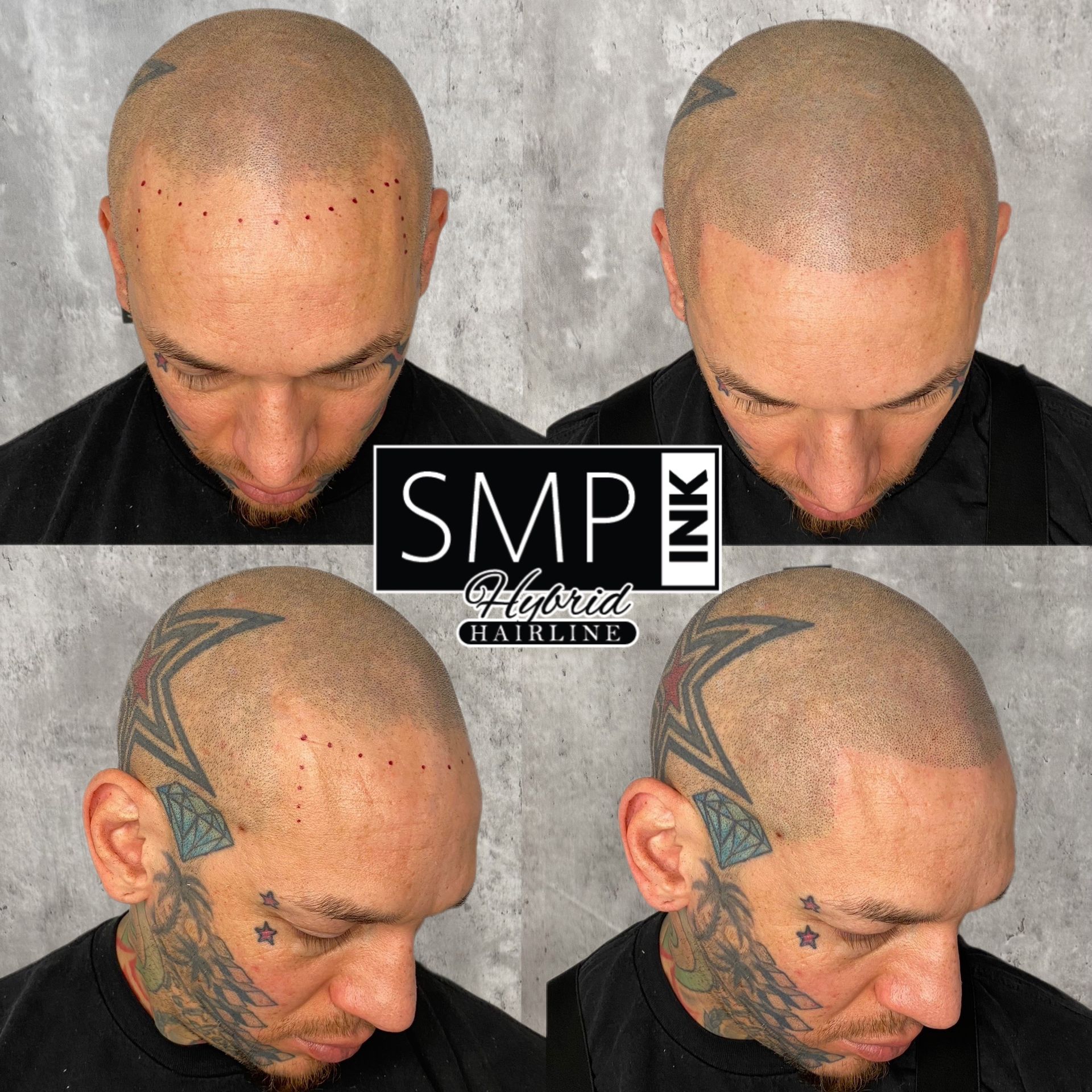 Four photos of a bald man showing scalp micropigmentation tattoo results from different angles.
