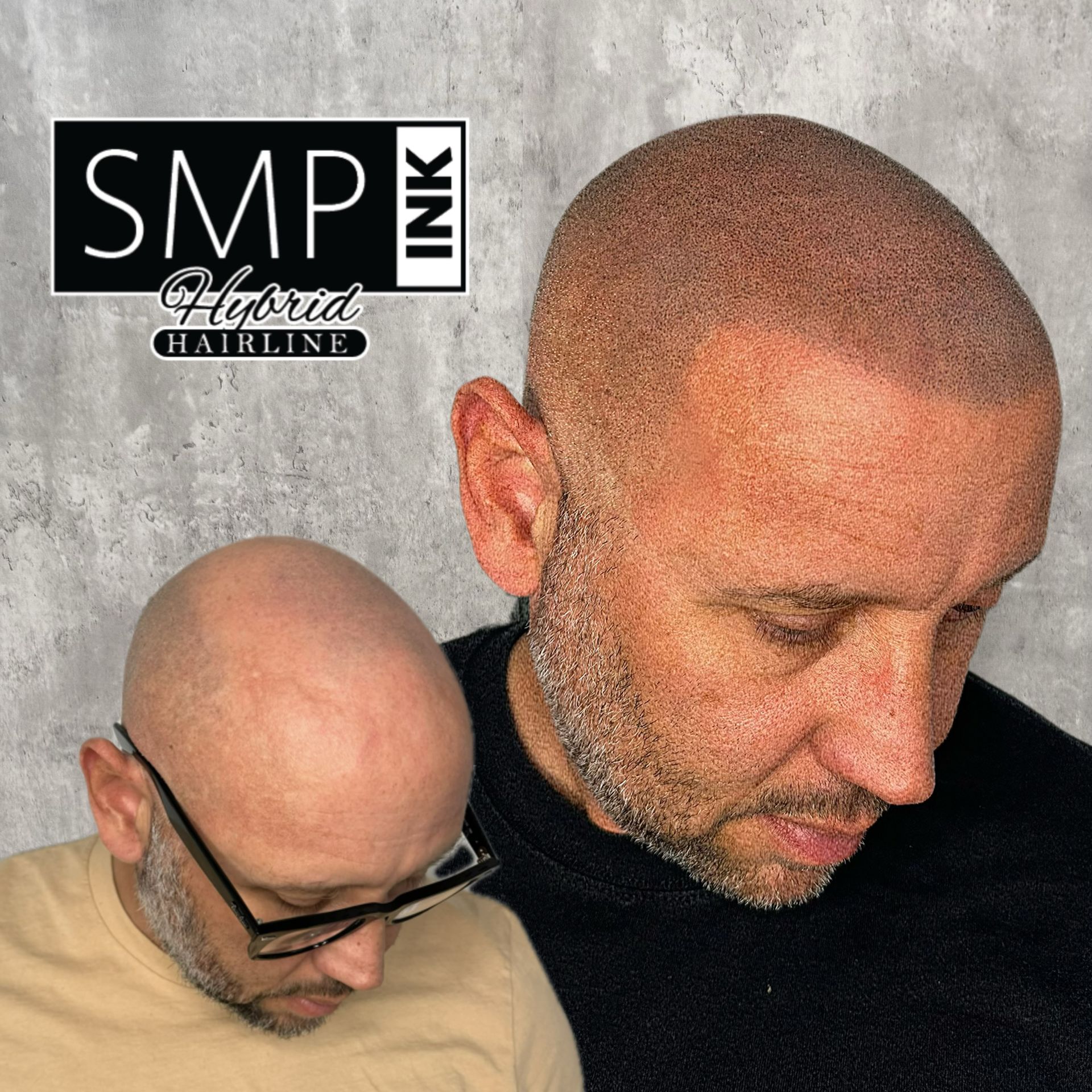 Two bald men showing scalp micropigmentation, with SMP Ink logo in the corner.