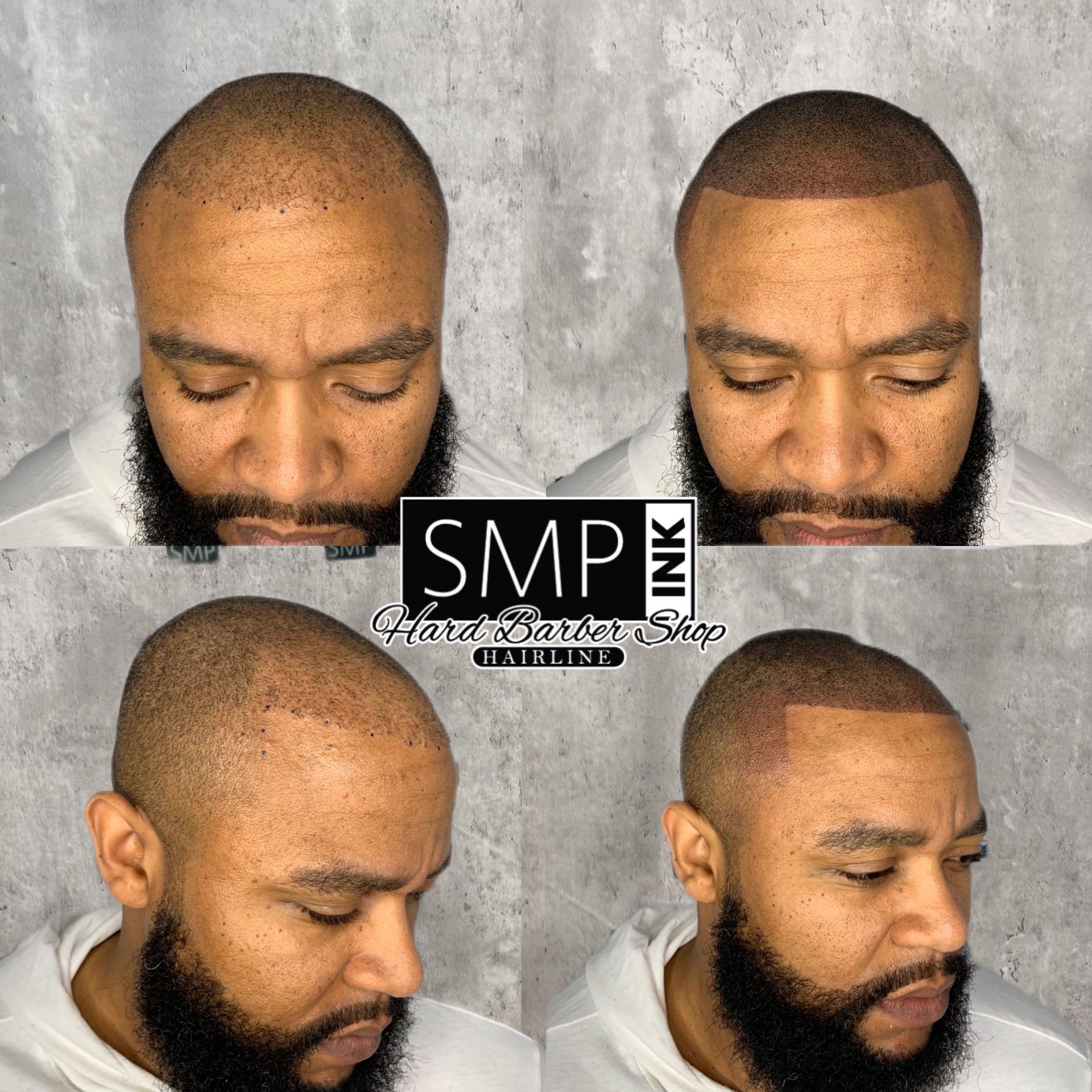 Four views of a man with a sharp beard fade haircut, shown front and side on a light background.