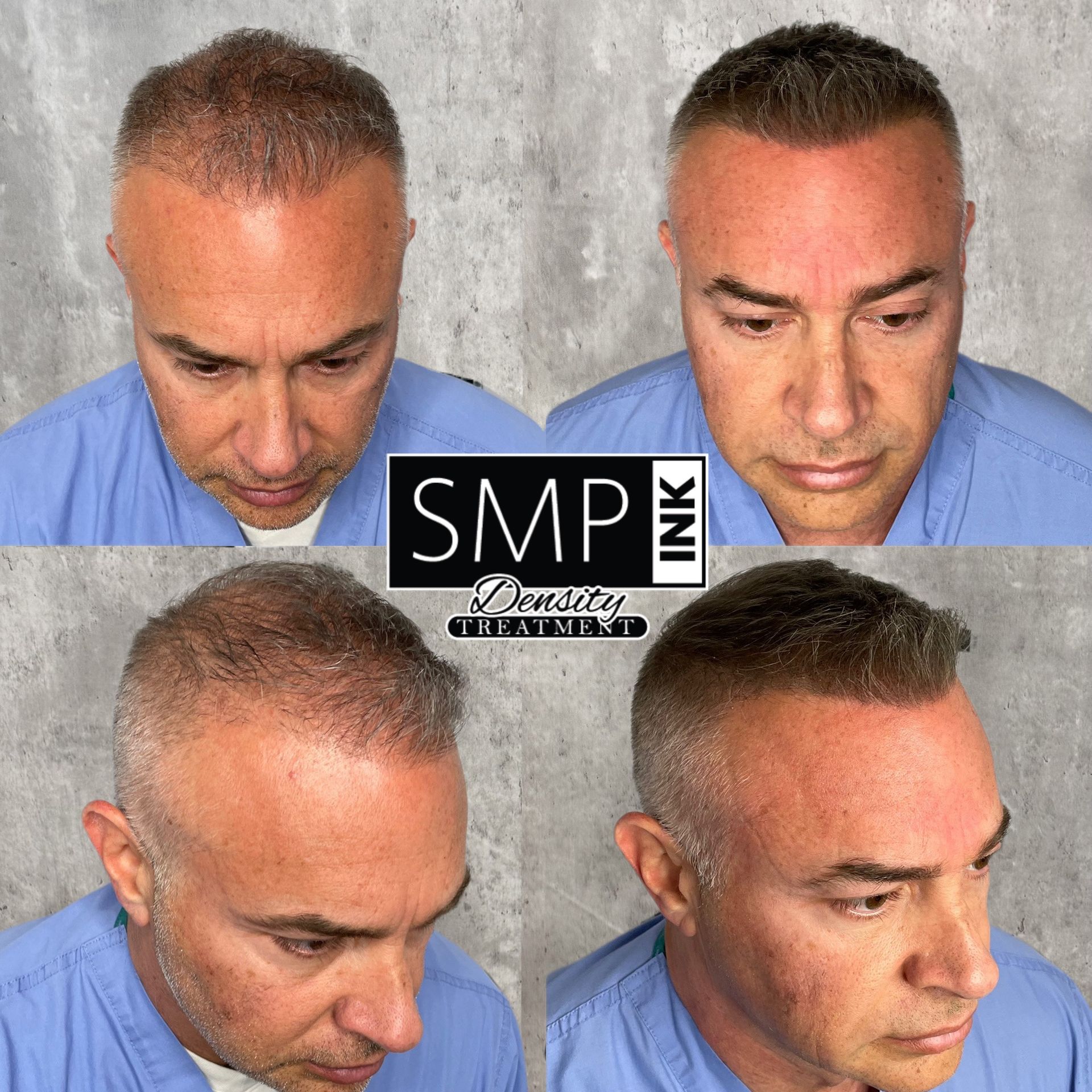 Four views of the same man with a short haircut against a gray background, showing different angles and lighting.