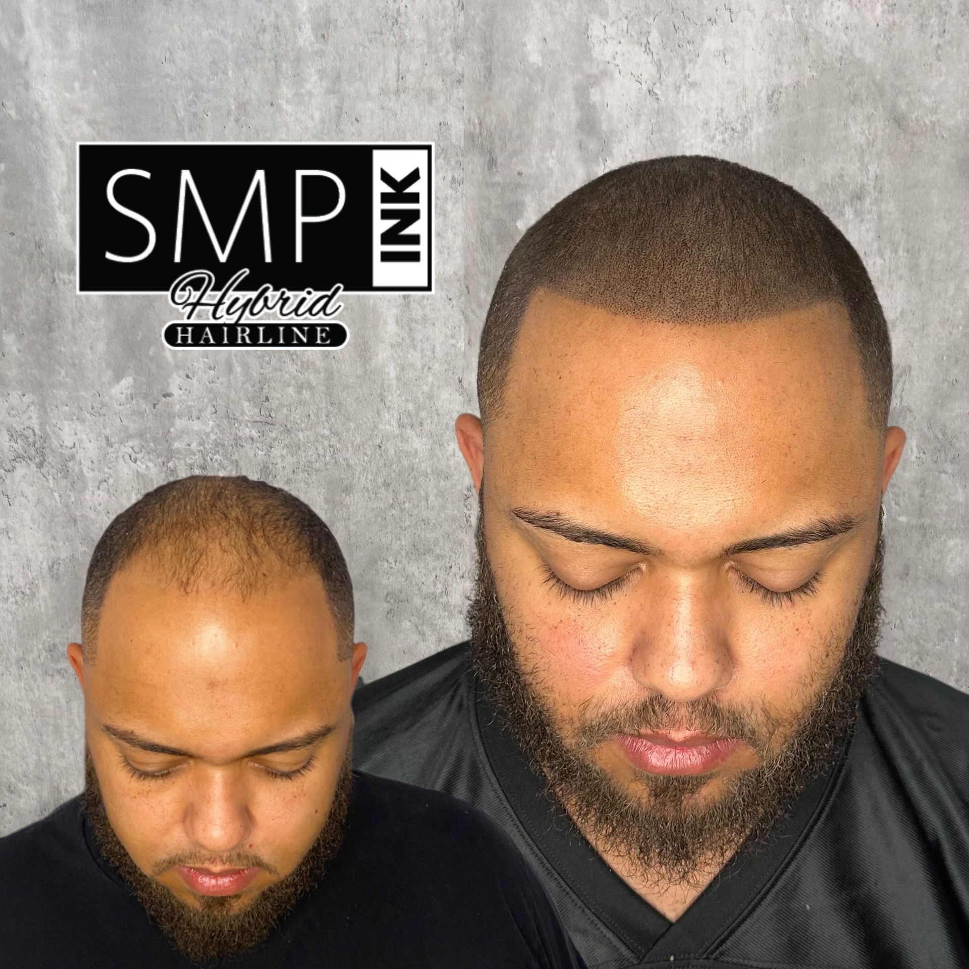 Side-by-side close-ups of a man with a trimmed beard and shaved head, one full-face and one top-down view.
