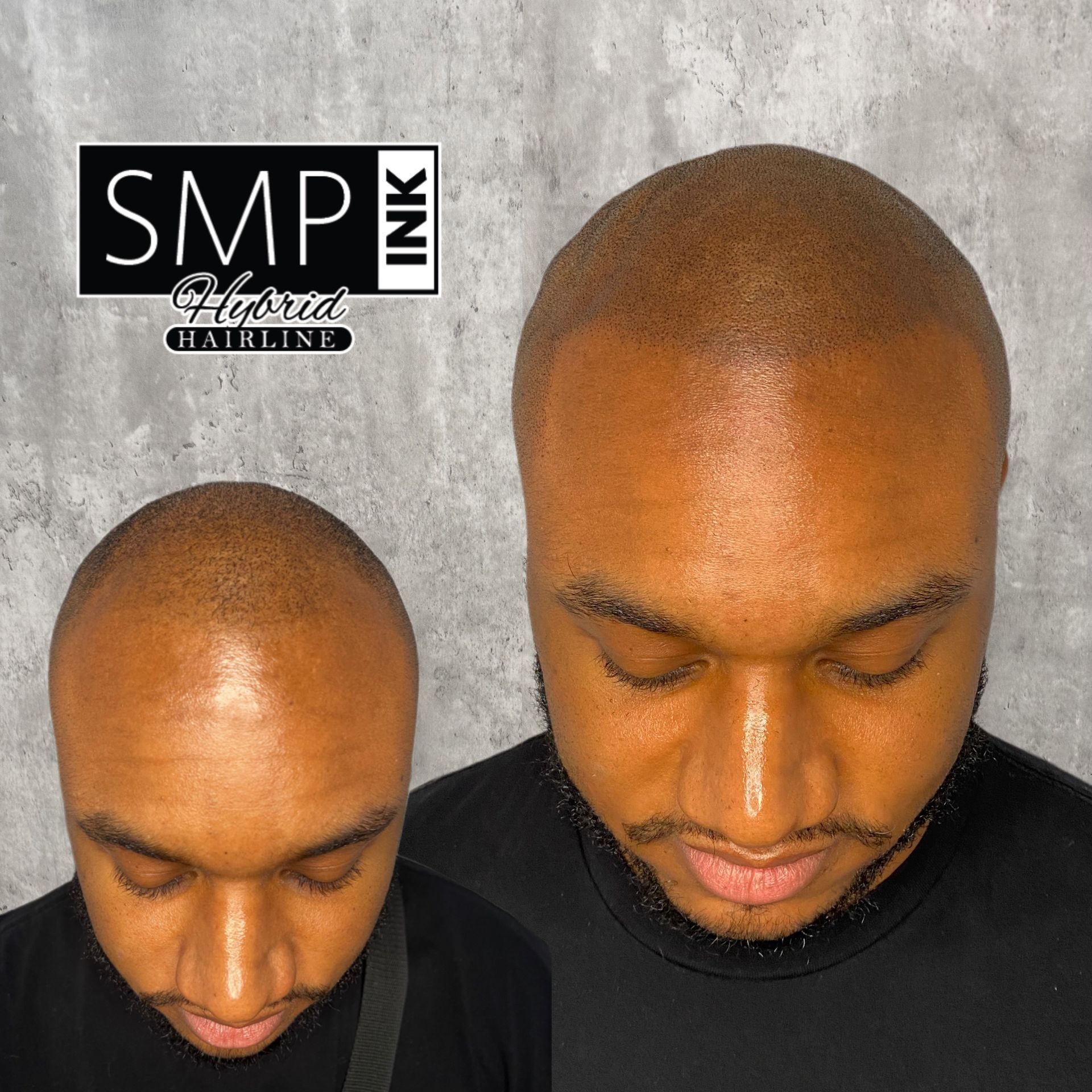 Side-by-side haircut comparison showing a shaved head and a closely cropped, shiny scalp.