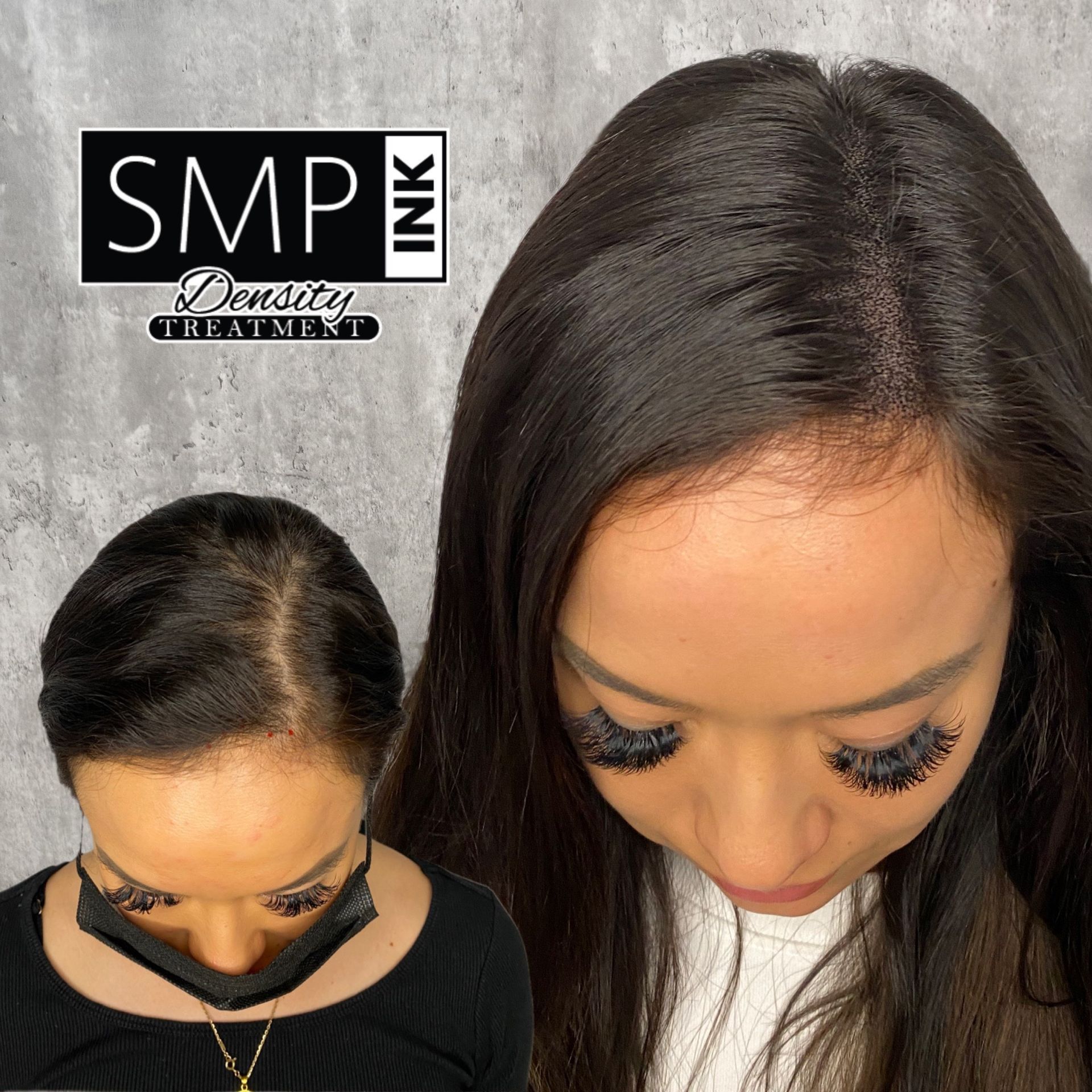 Before-and-after view of a woman showing scalp micropigmentation at the hairline and part.