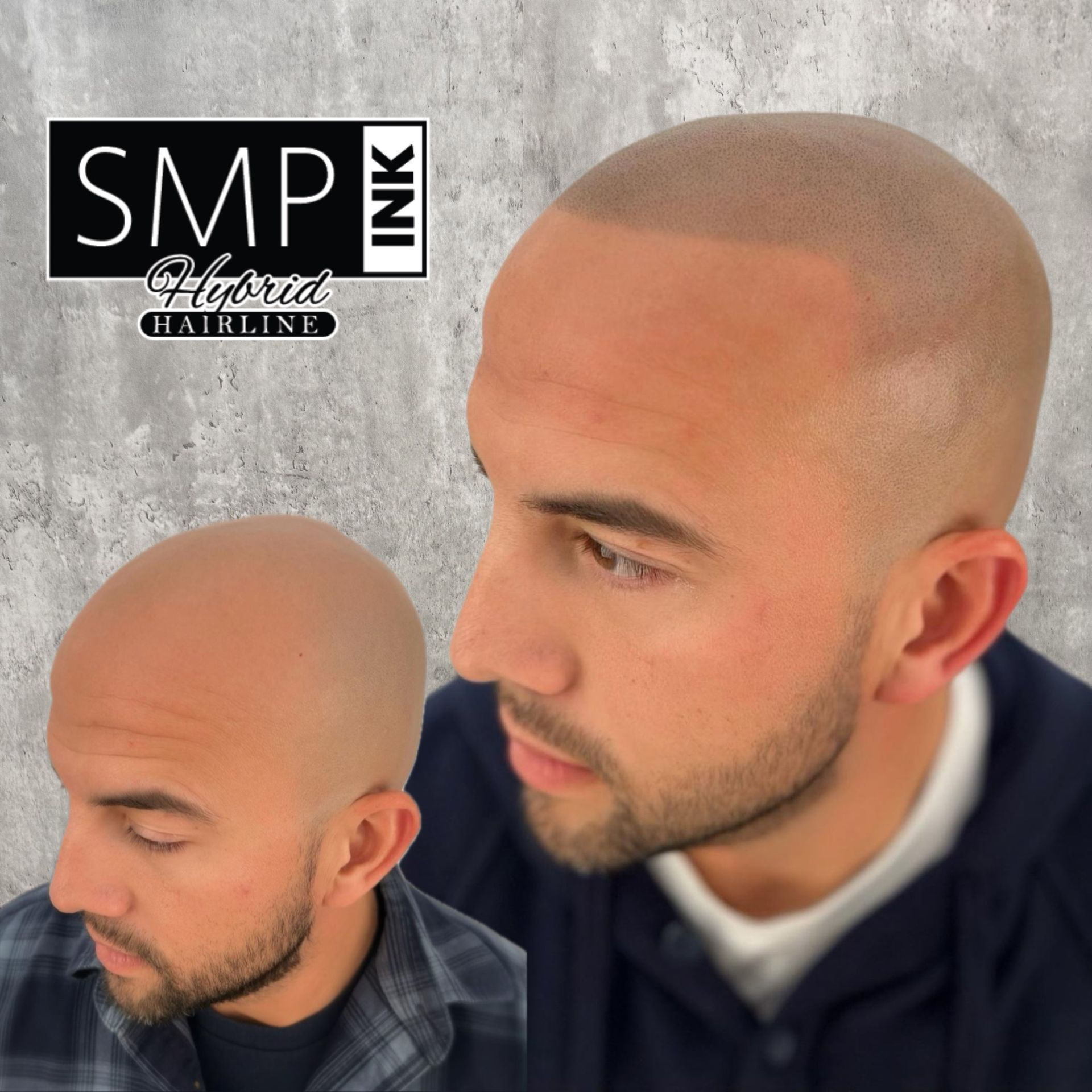Two bald men in profile, one large and one small, against a gray background with a logo in the corner