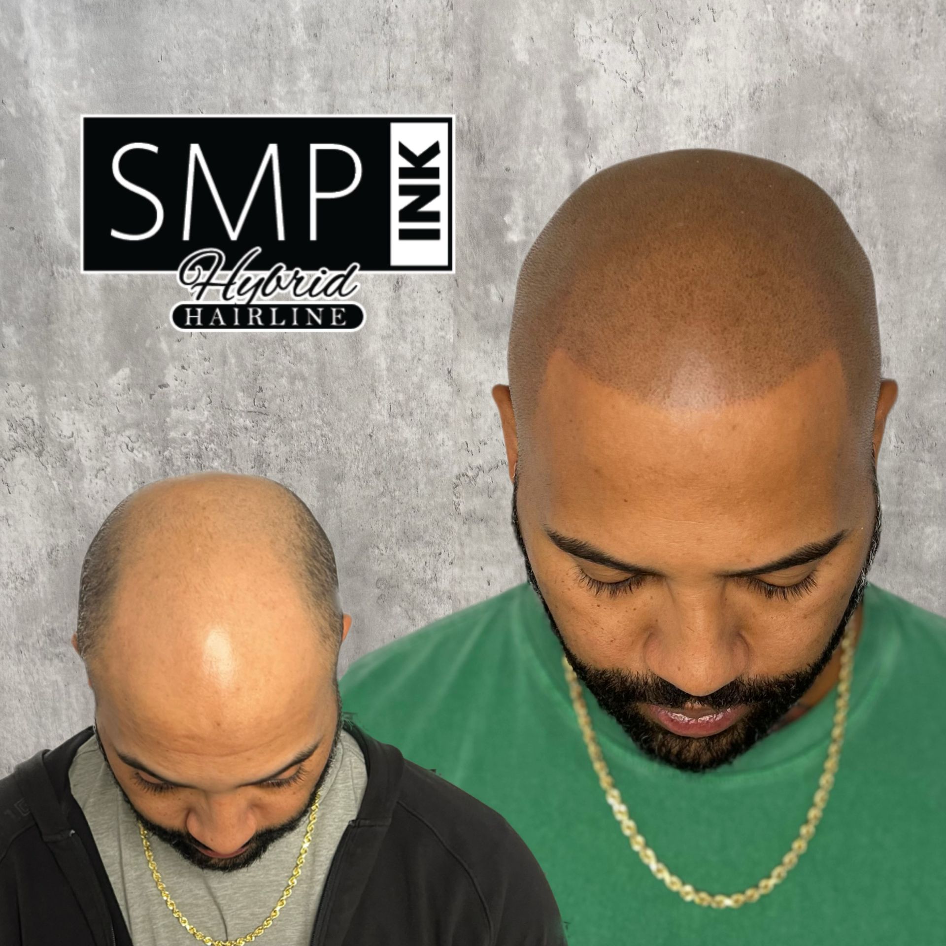 Before-and-after haircut comparison with shaved head and a groomed hairline, labeled “SMP INK Florida Hairline.”