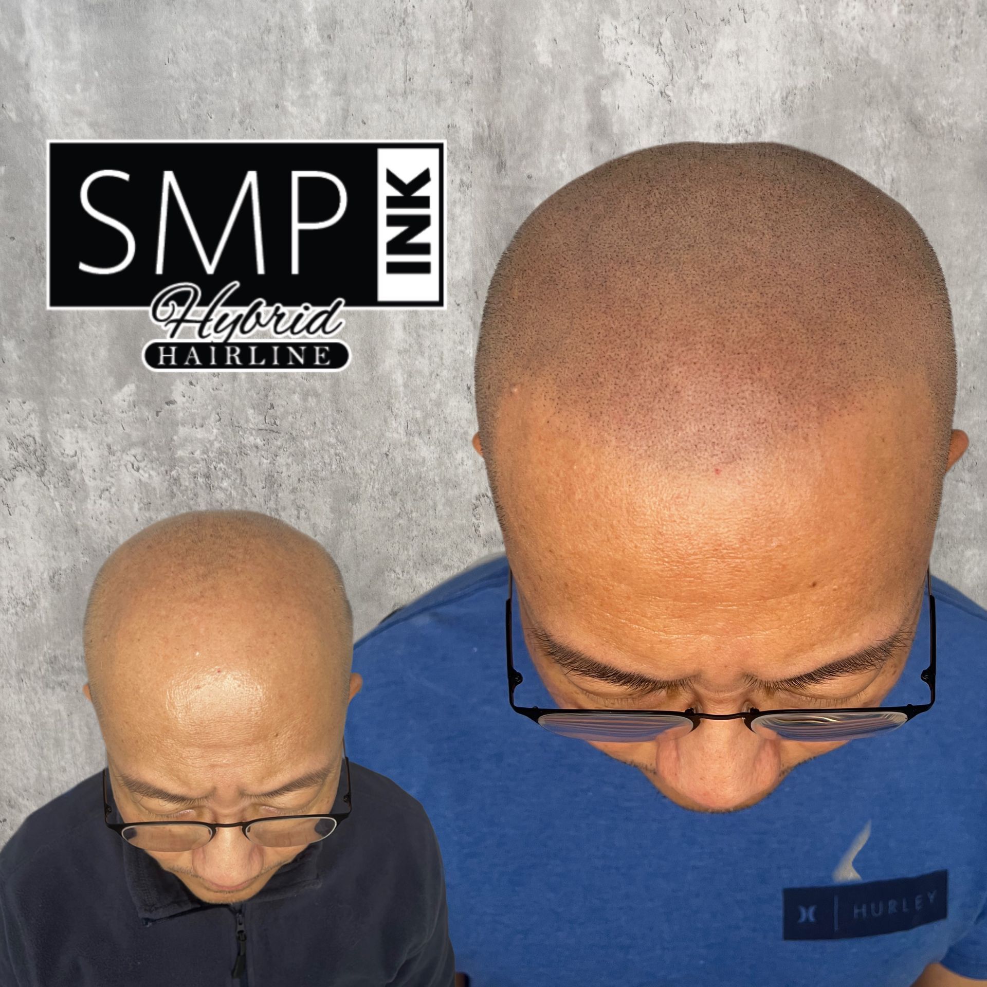 Two top-down views of a closely shaved head, with a hair salon logo and watermark on a gray background