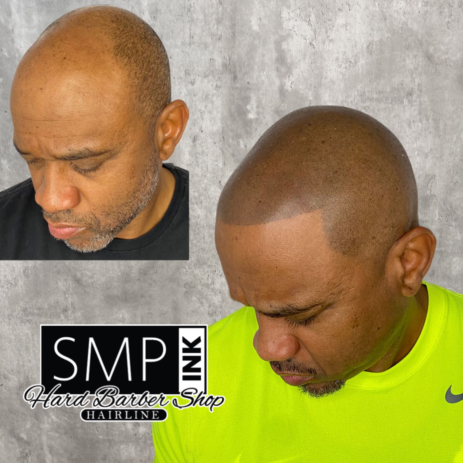 Before-and-after scalp micropigmentation on a bald head, showing a fuller hairline; SMP INK logo included.