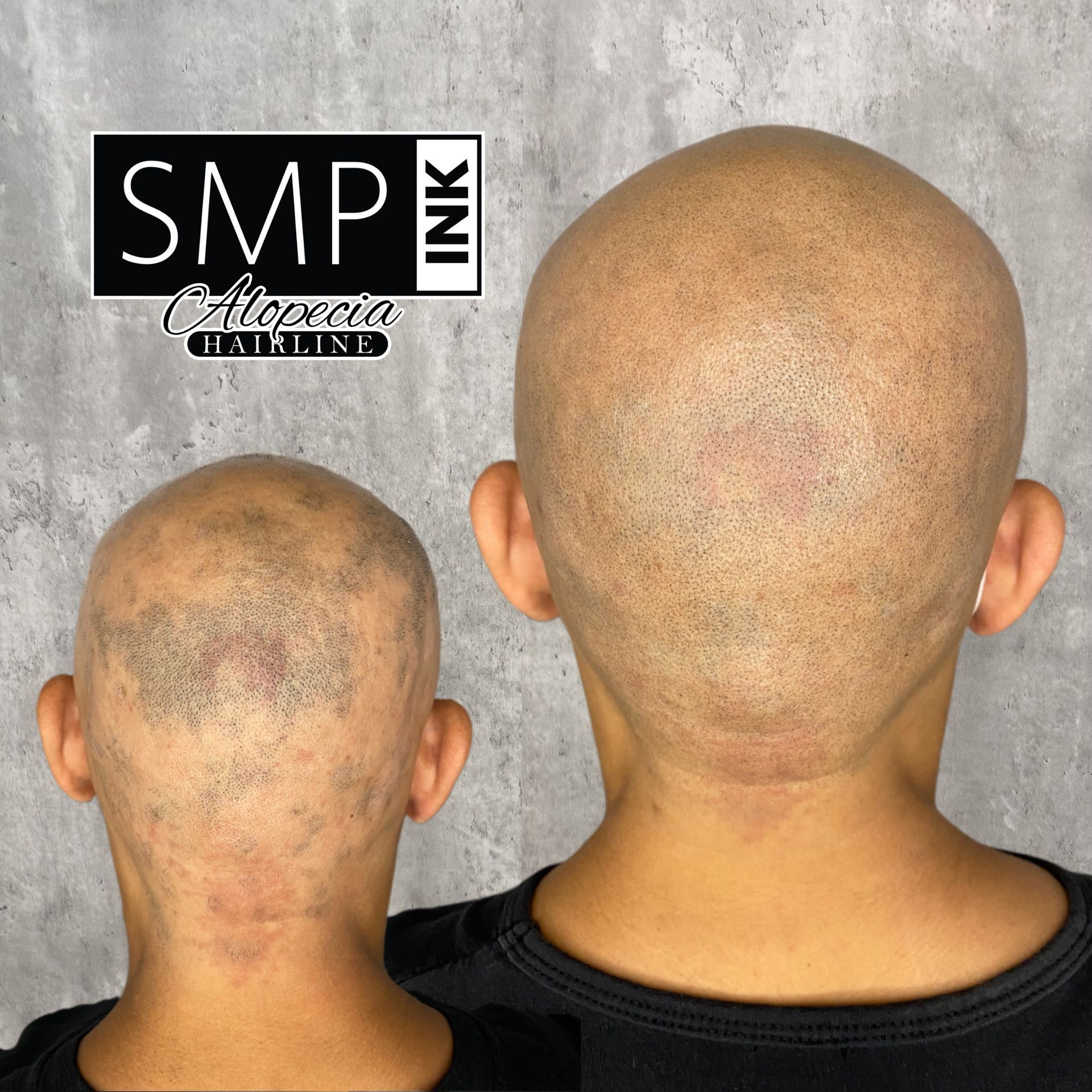 SMP Inc CDA before and after