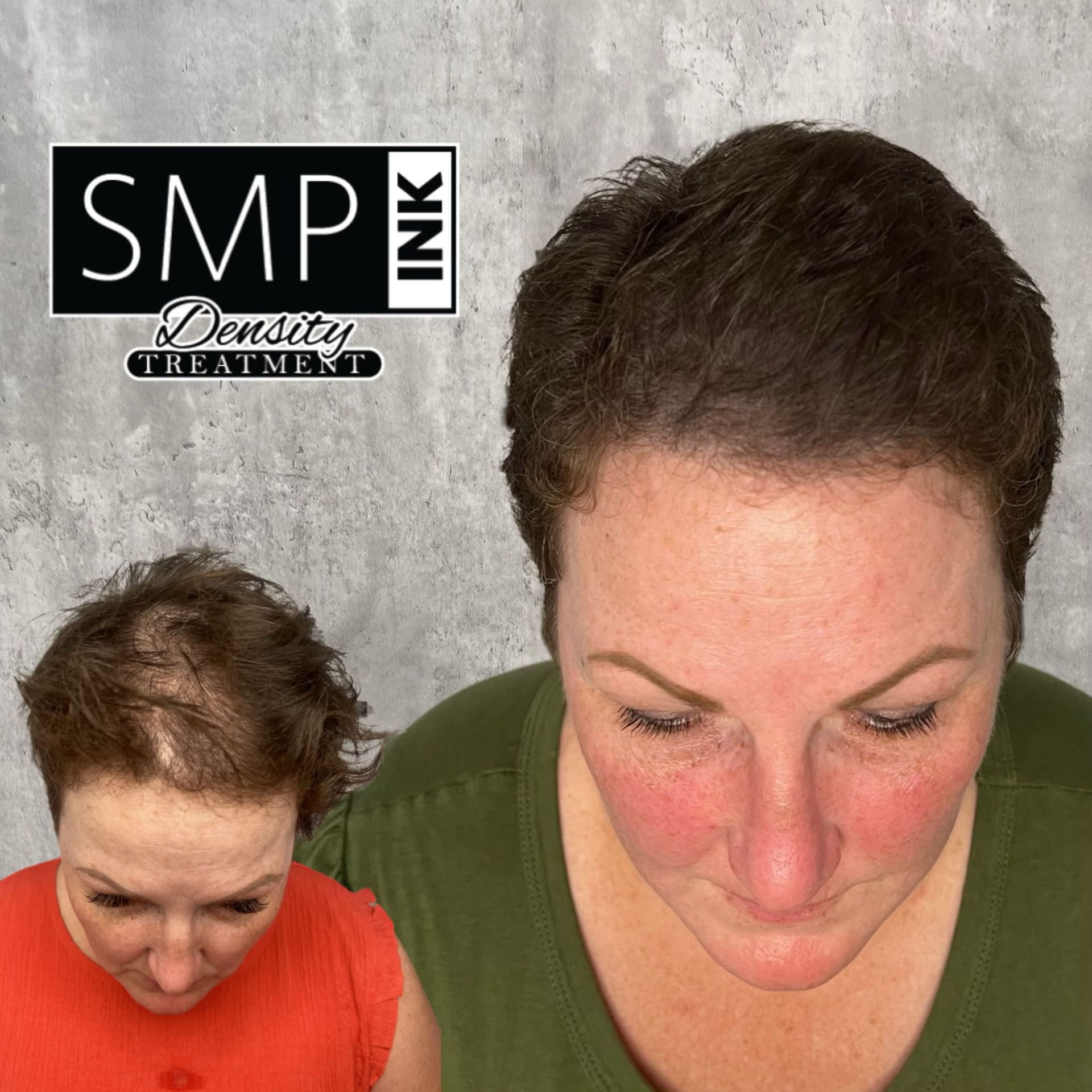 Two women in orange shirts look down; SMP Ink density treatment logo on gray background