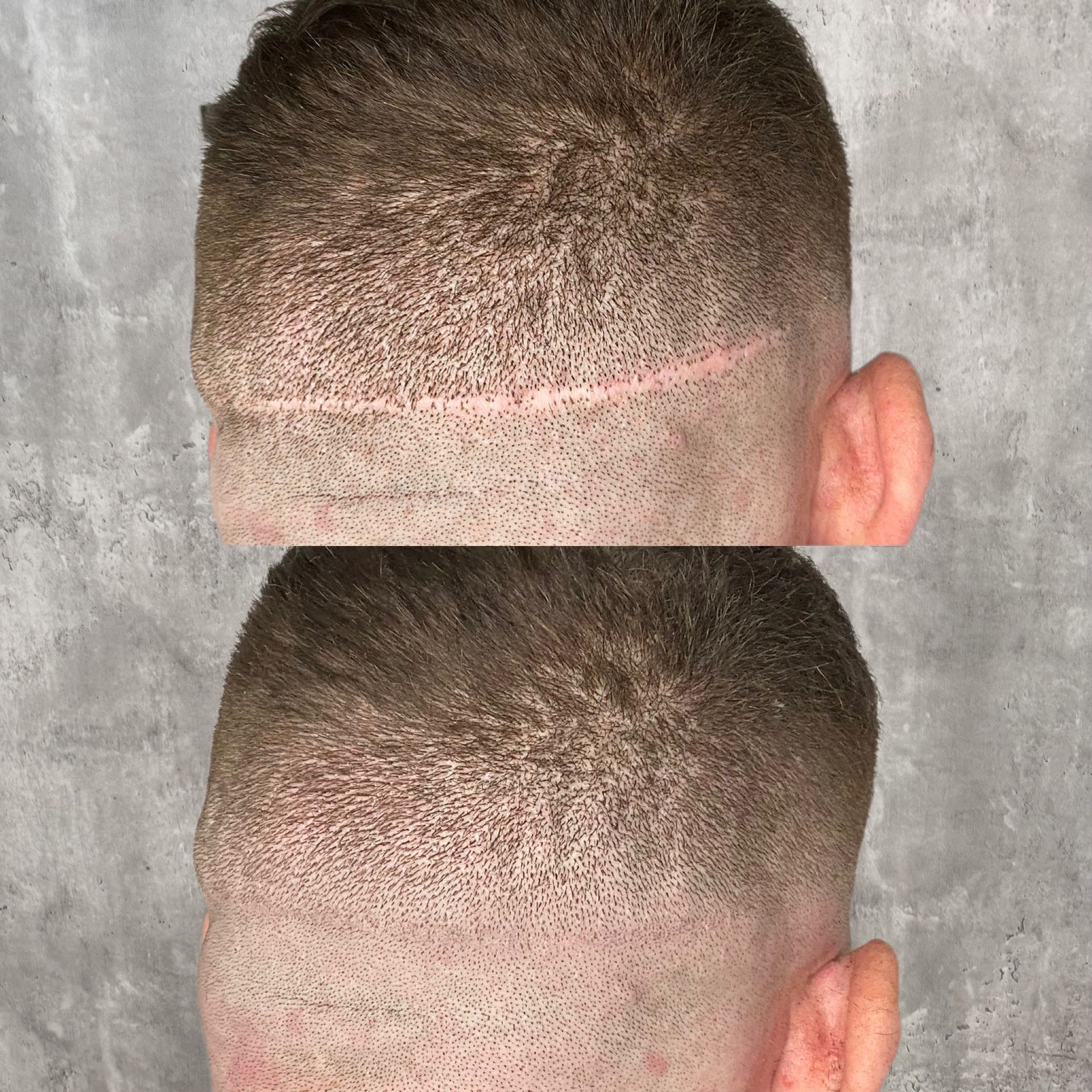 Close-up of a short buzz cut with a visible horizontal shaved line, shown in two stacked views.